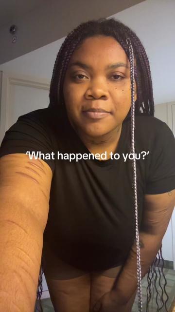 @I.brenanii