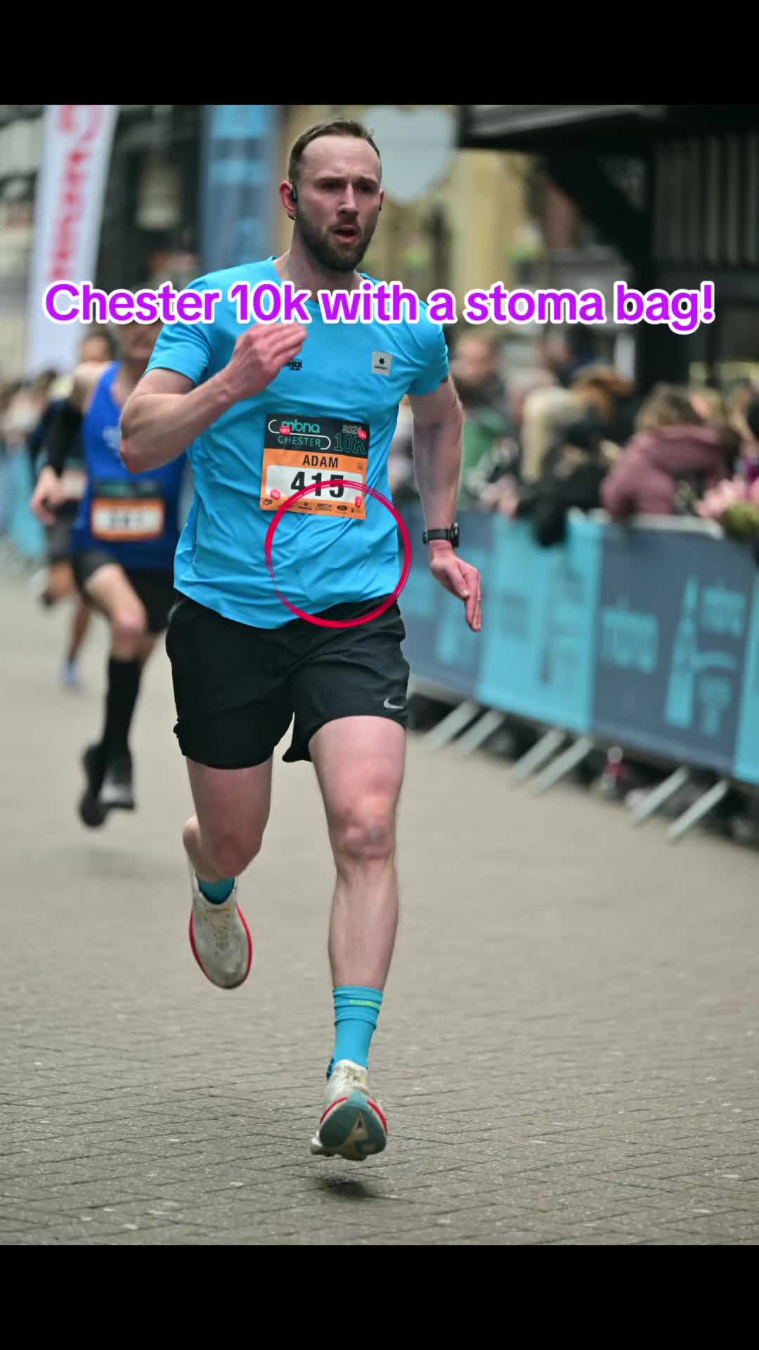 @Running Stoma