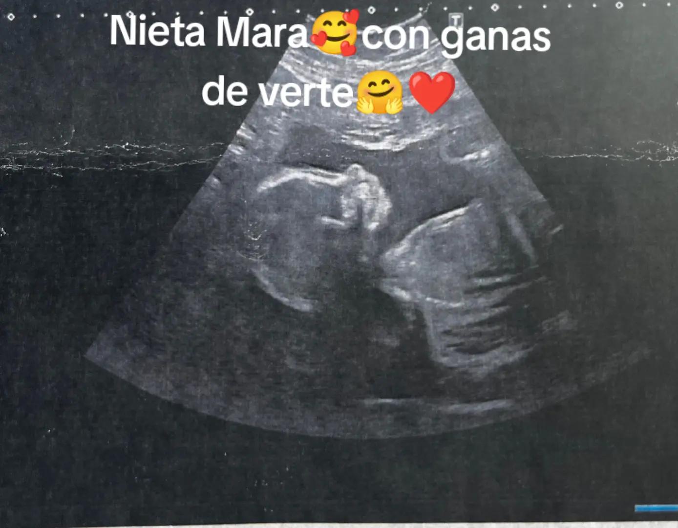 @Sandra 💫