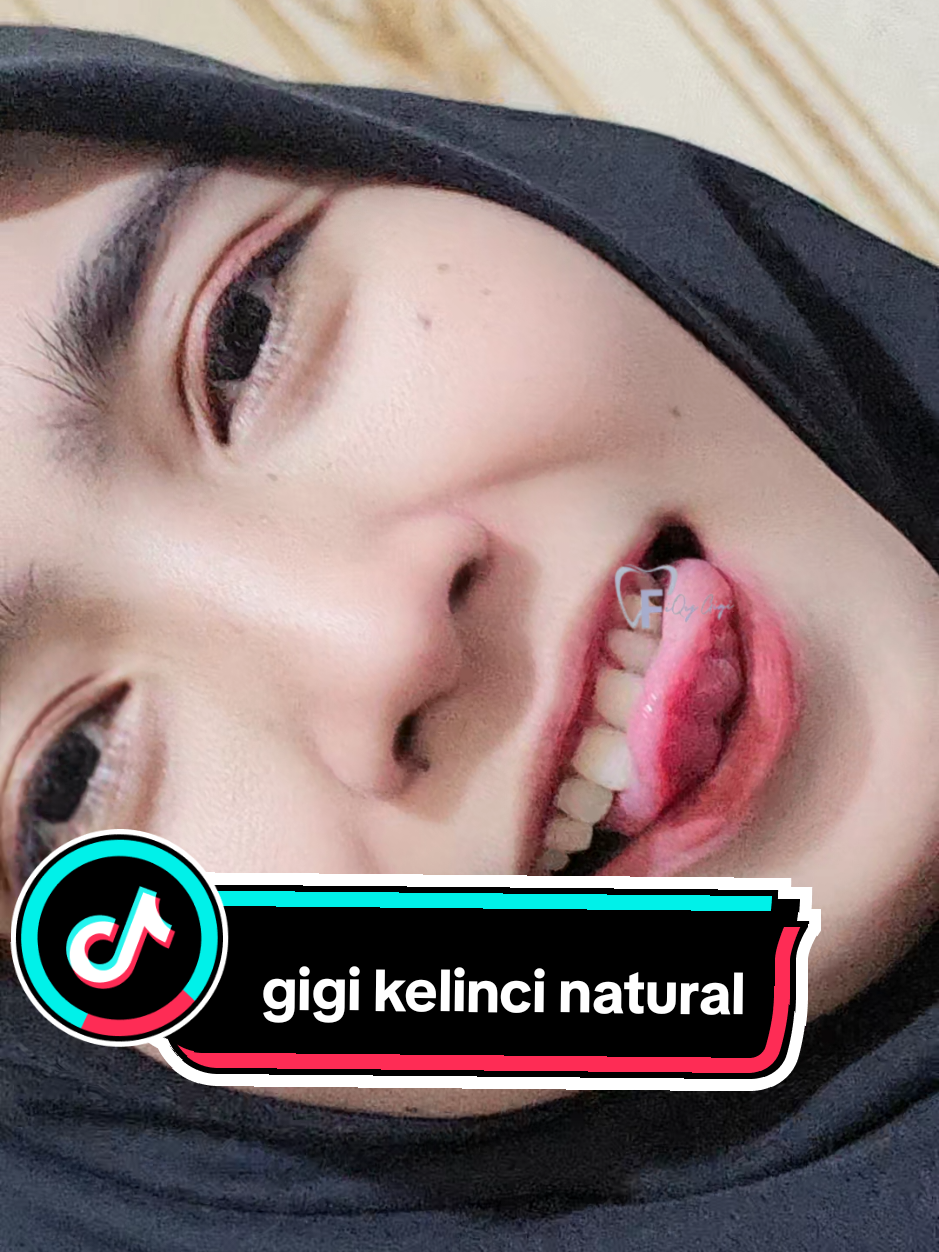@Fiqygigi