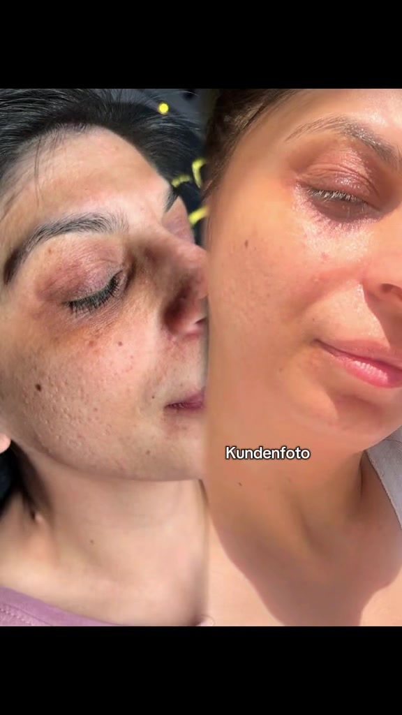 @𝐌𝐈𝐑𝐀𝐒 𝐁𝐄𝐀𝐔𝐓𝐘𝐁𝐀𝐑&reg;