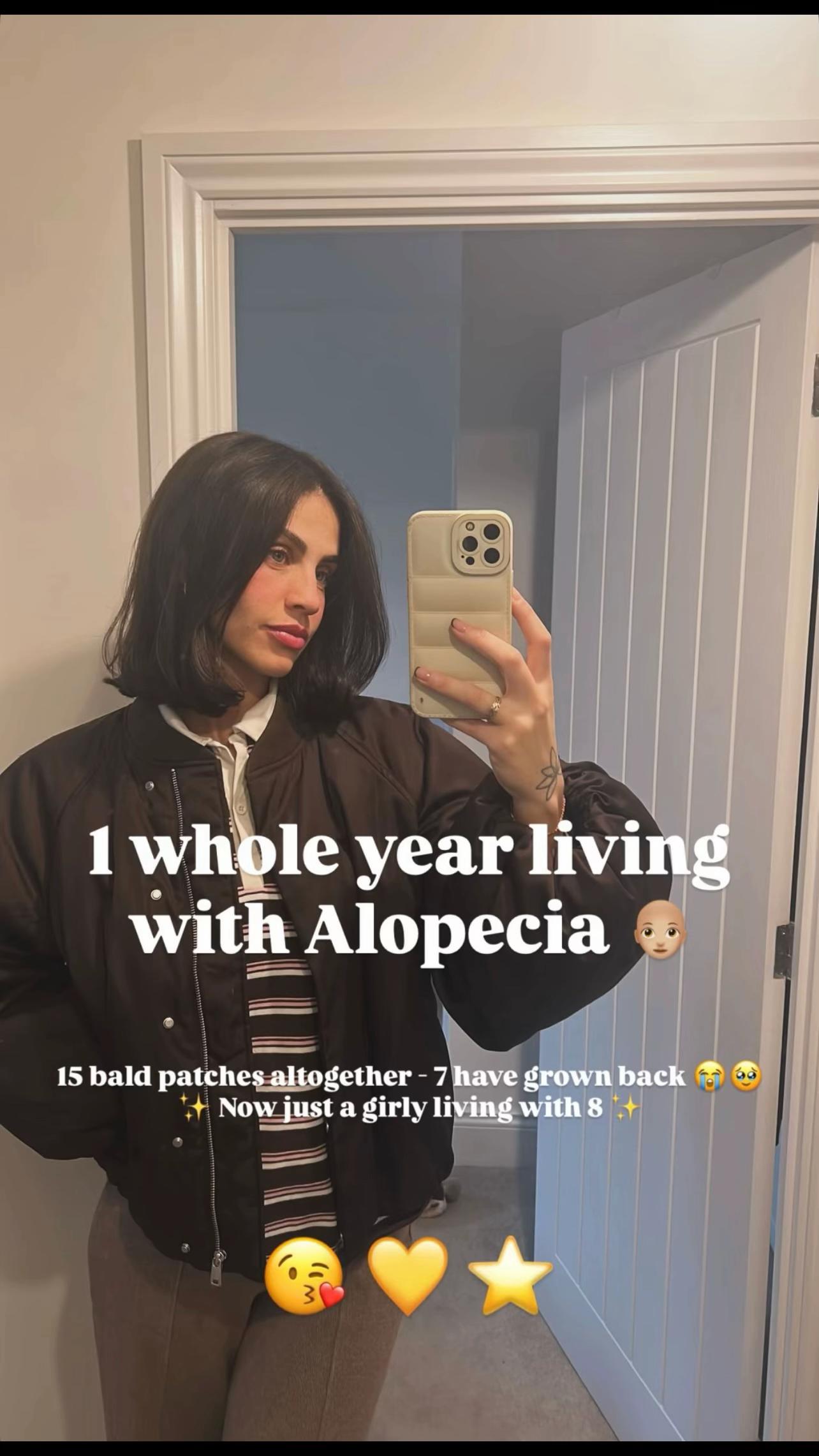 @TheBaldTruth