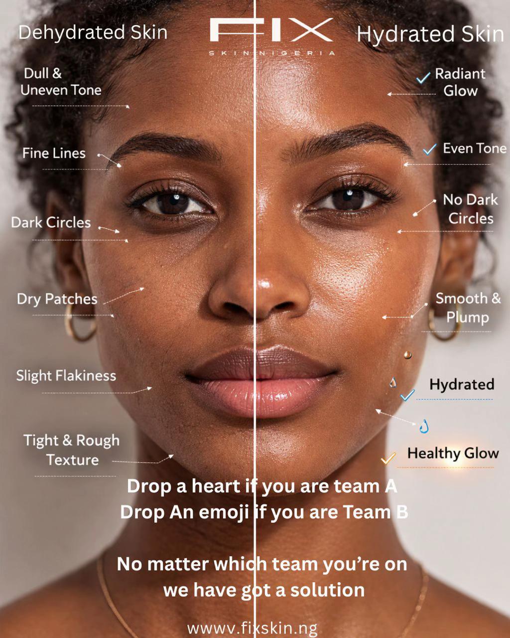@FIX SKIN NIGERIA