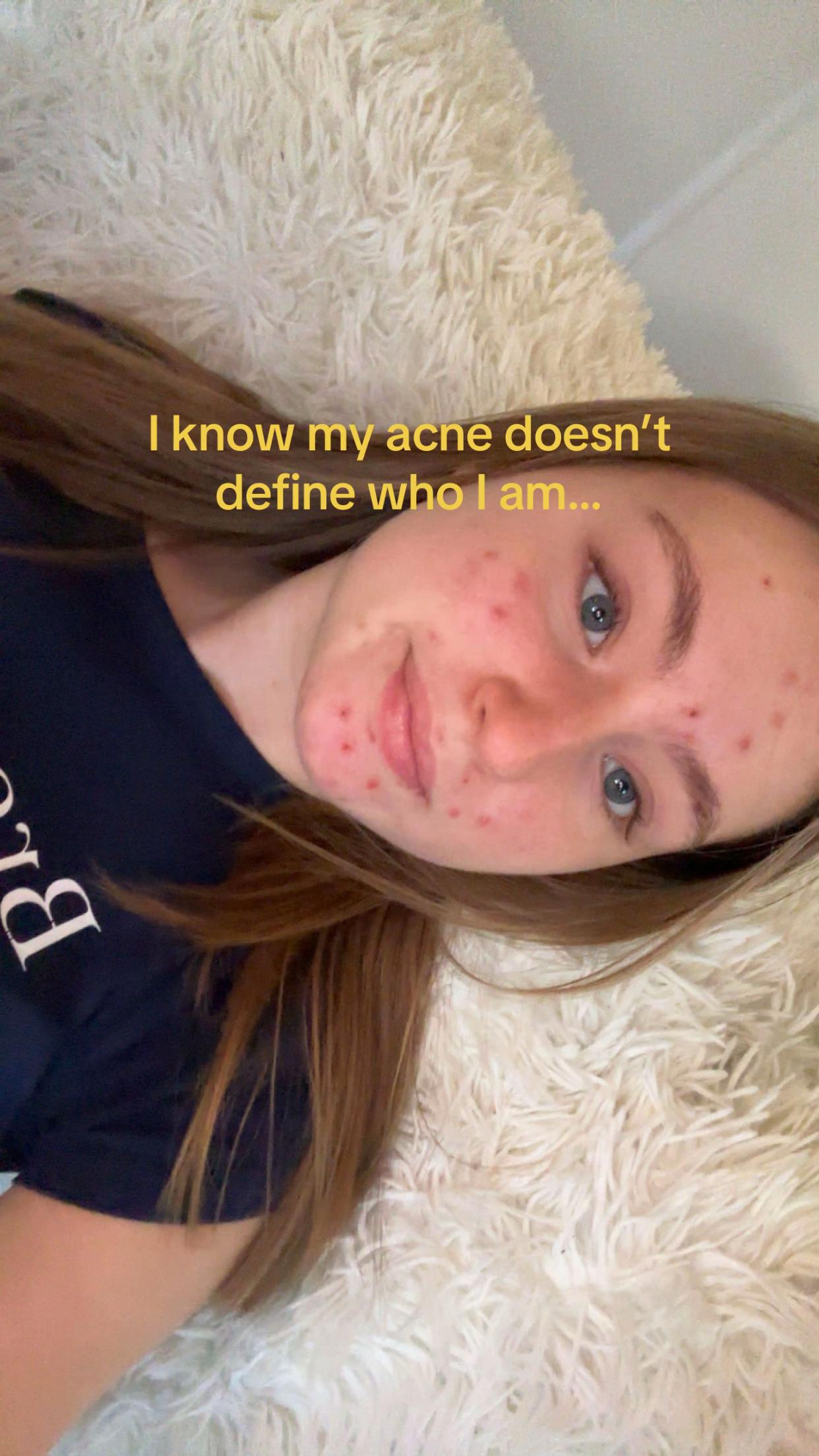 @isislinnemans