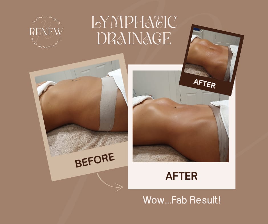 @RENEW EK - SKIN & LASER CLINIC