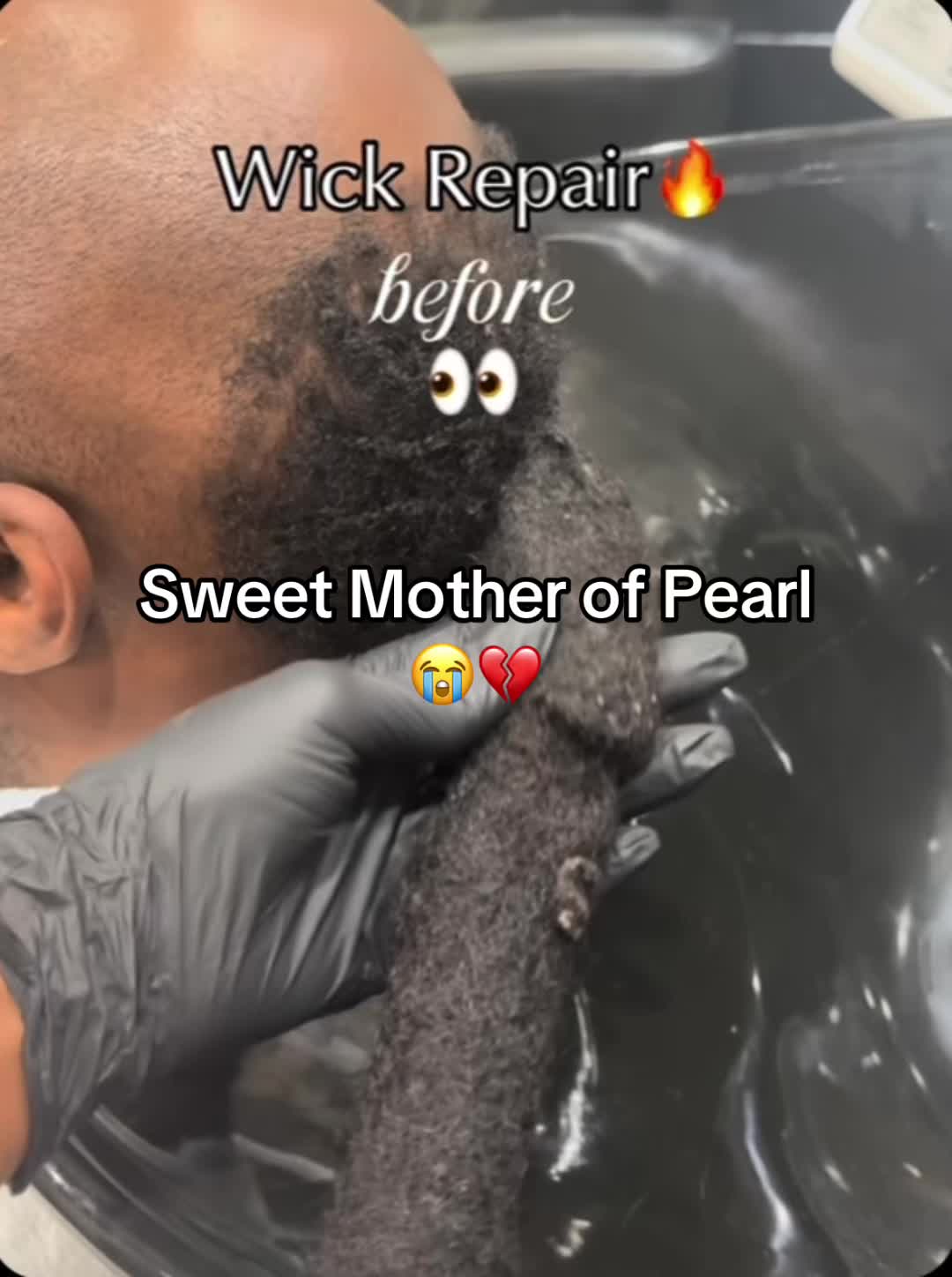 @Hxbitz