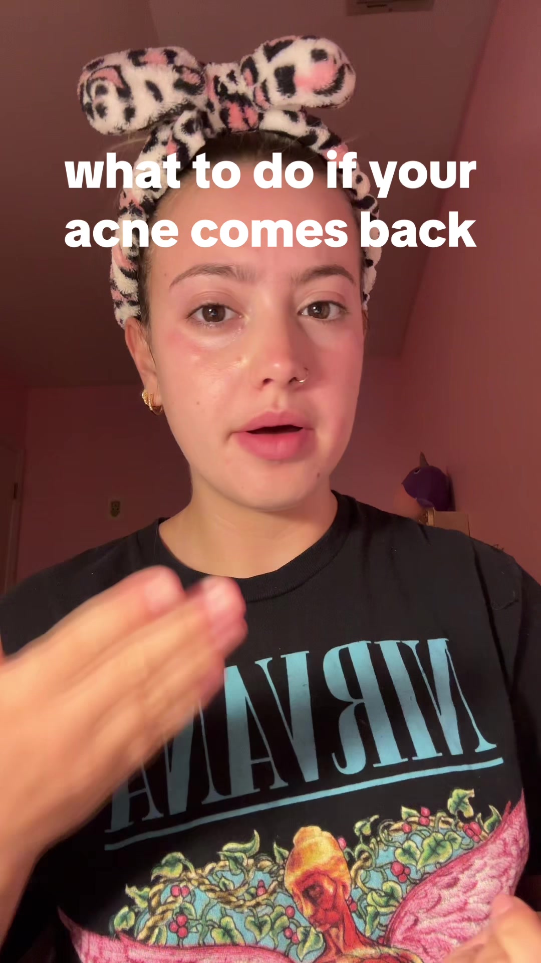@cheeto🙈