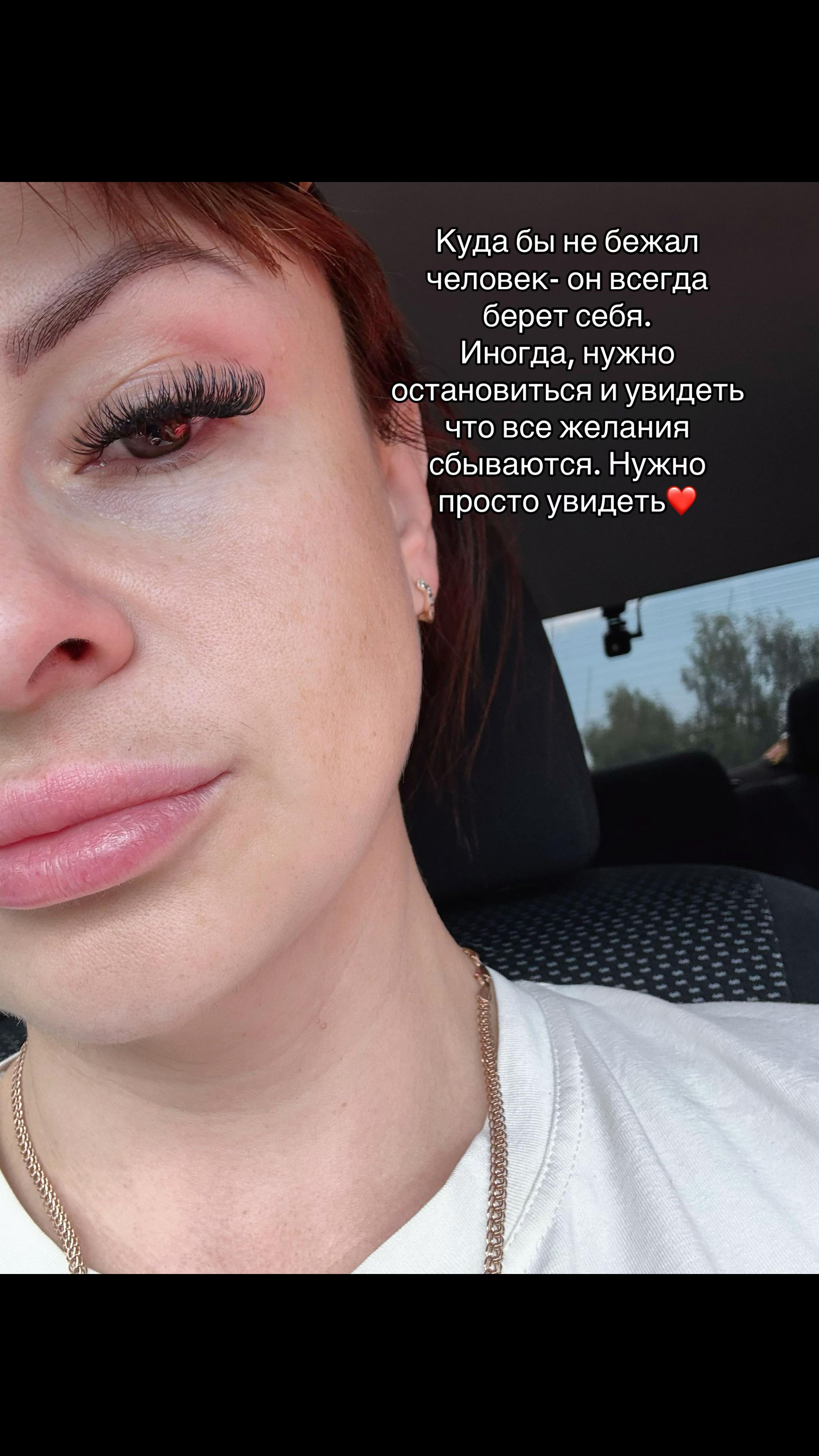 @Repka