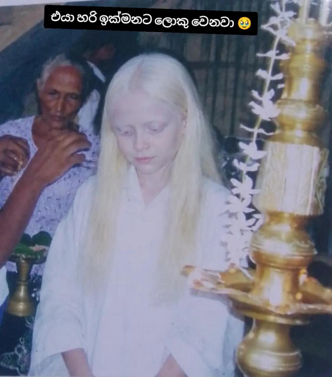 @🧝🤍Albino Girl LK🤍🧝🩵