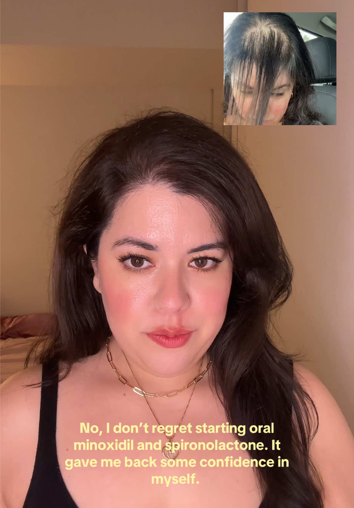 @Bianca