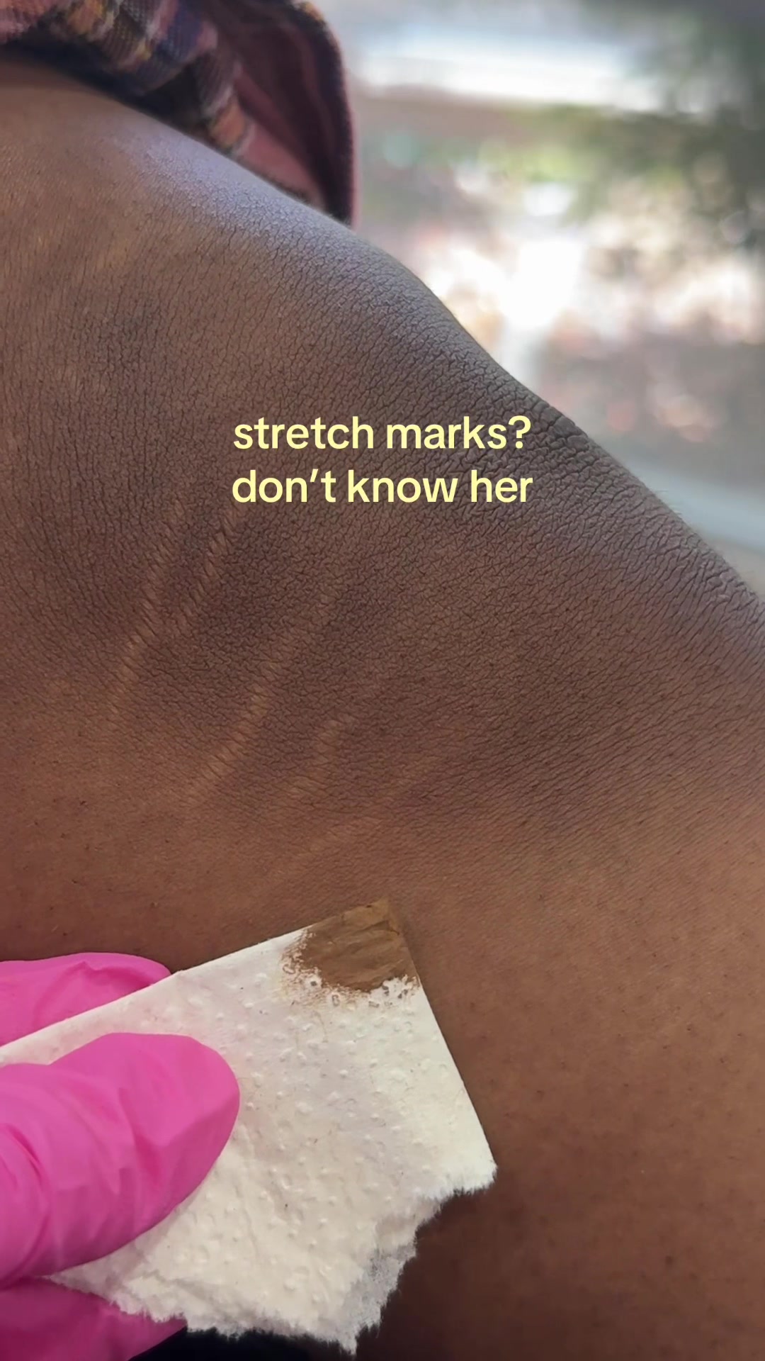 @Stretch Mark Fairy 🧚✨