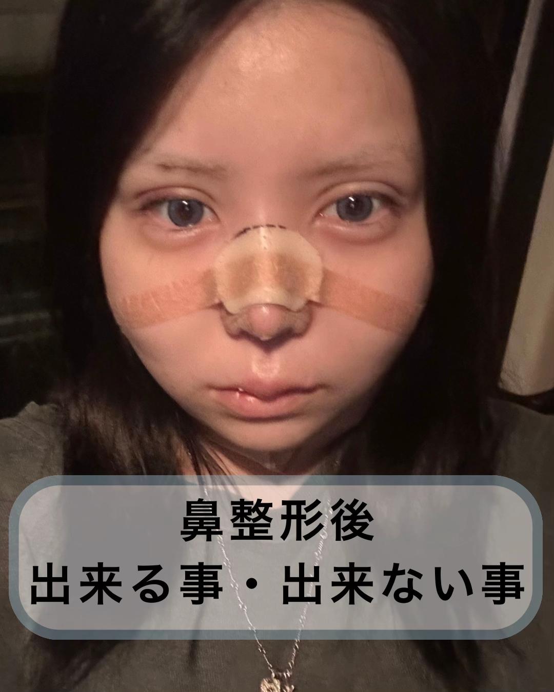 @鼻整形R Beauty CLINIC 副院長👨&zwj;⚕️吉田慧