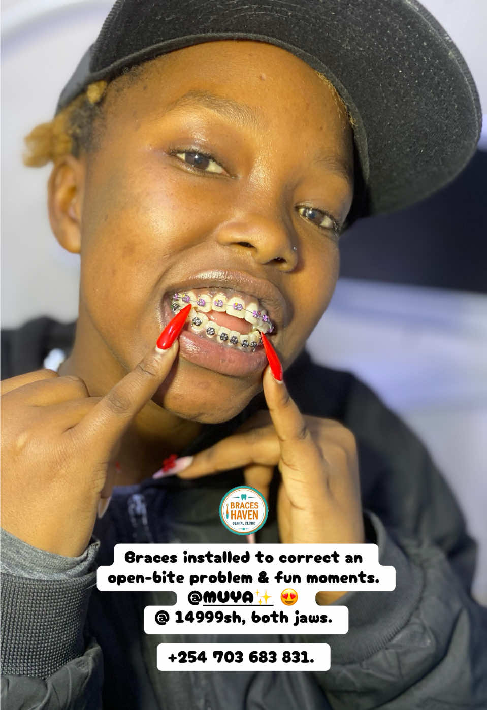 @Braces Haven Nairobi Dental