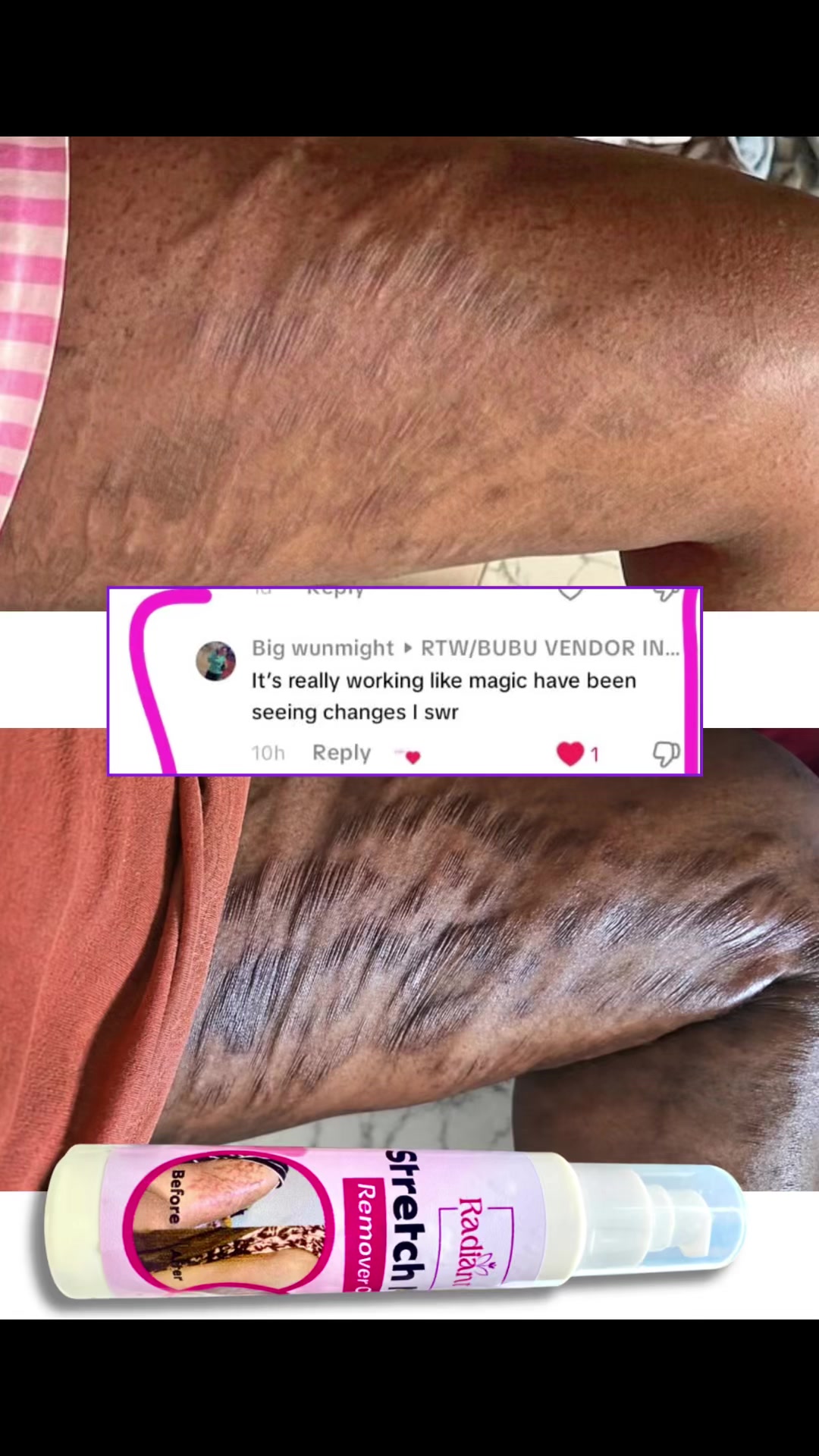 @Radiant skin