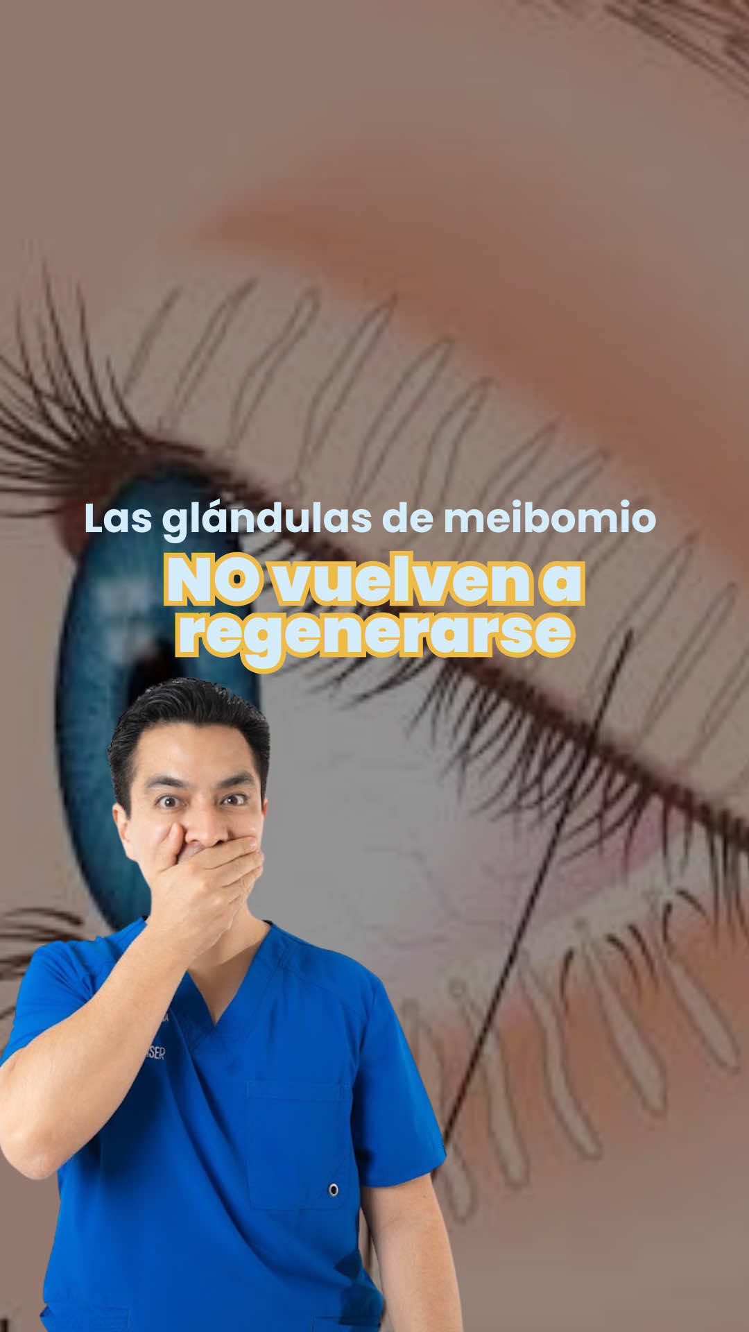 @visionlaser