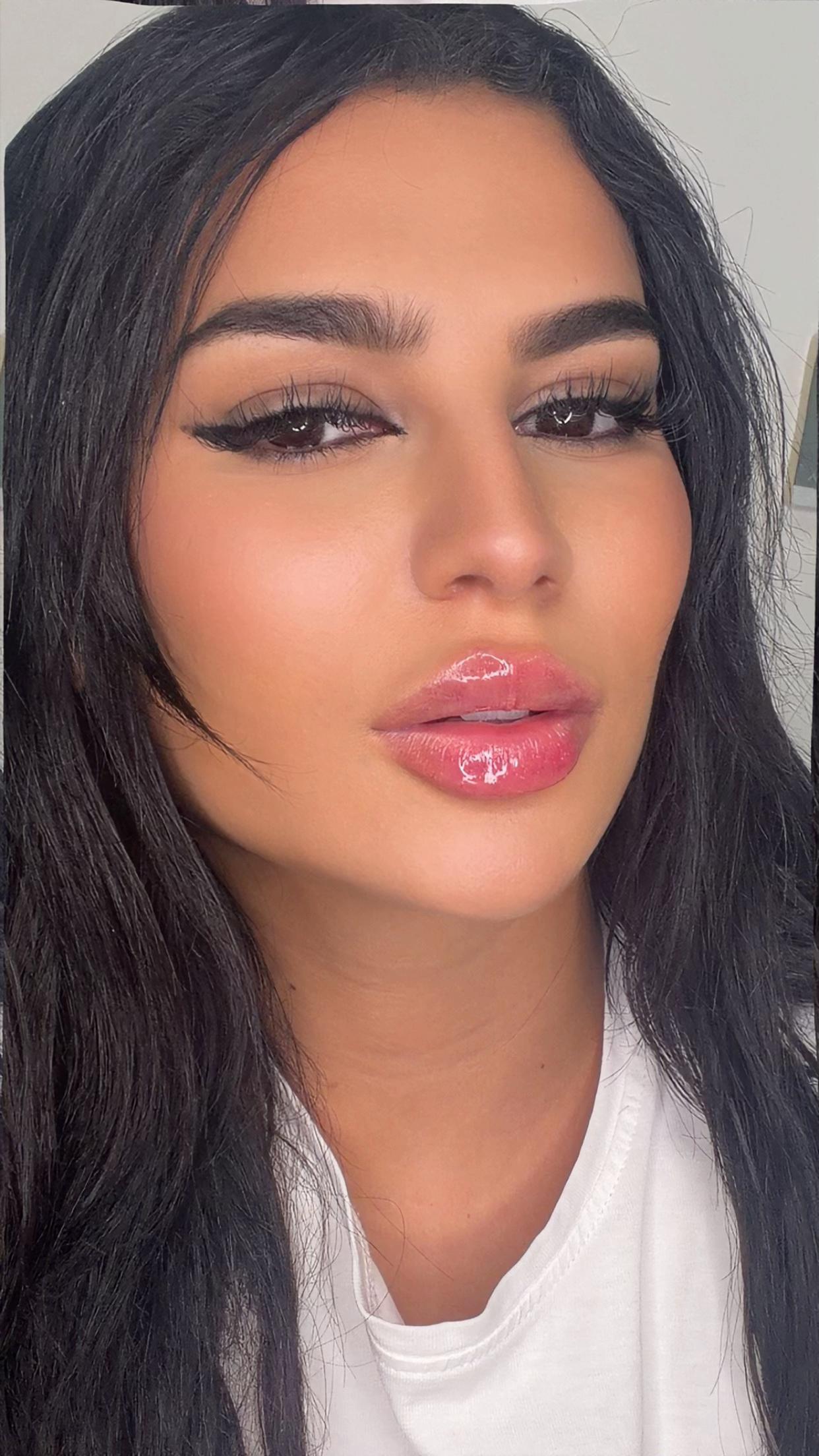 @نورة فيرزاتشي