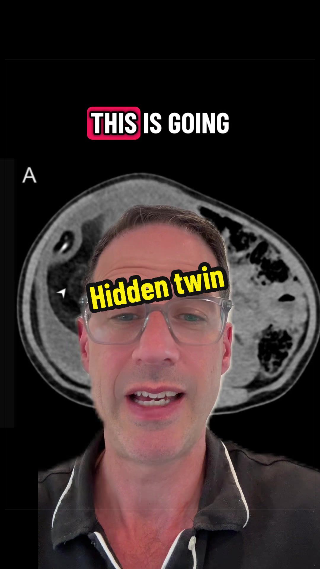 @Dr Michael Narvey 🇨🇦