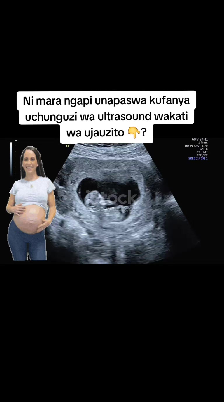 @IC Uzazi zone na Doc Chalamila