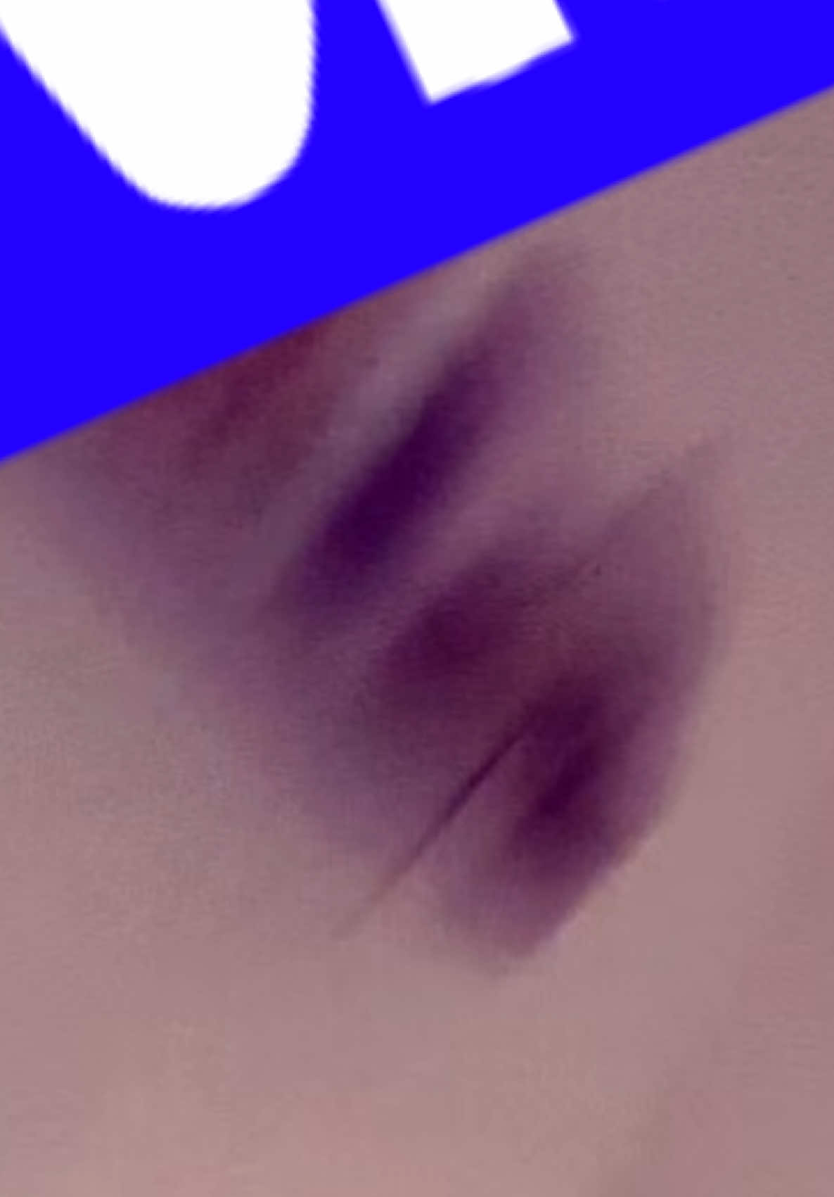 @๐๐ช๐ฝ๐ฒ๐ฎ-๐ต๐ฎ๐ฒ๐ฐ๐ฑโฆ
