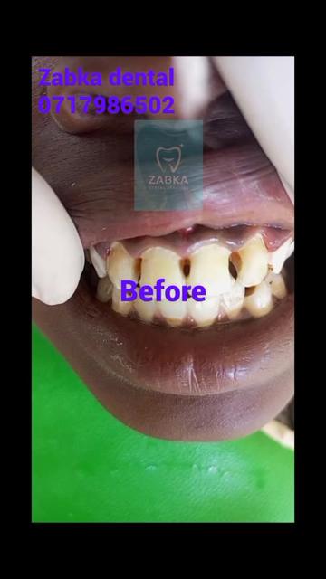 @Zabka Dental