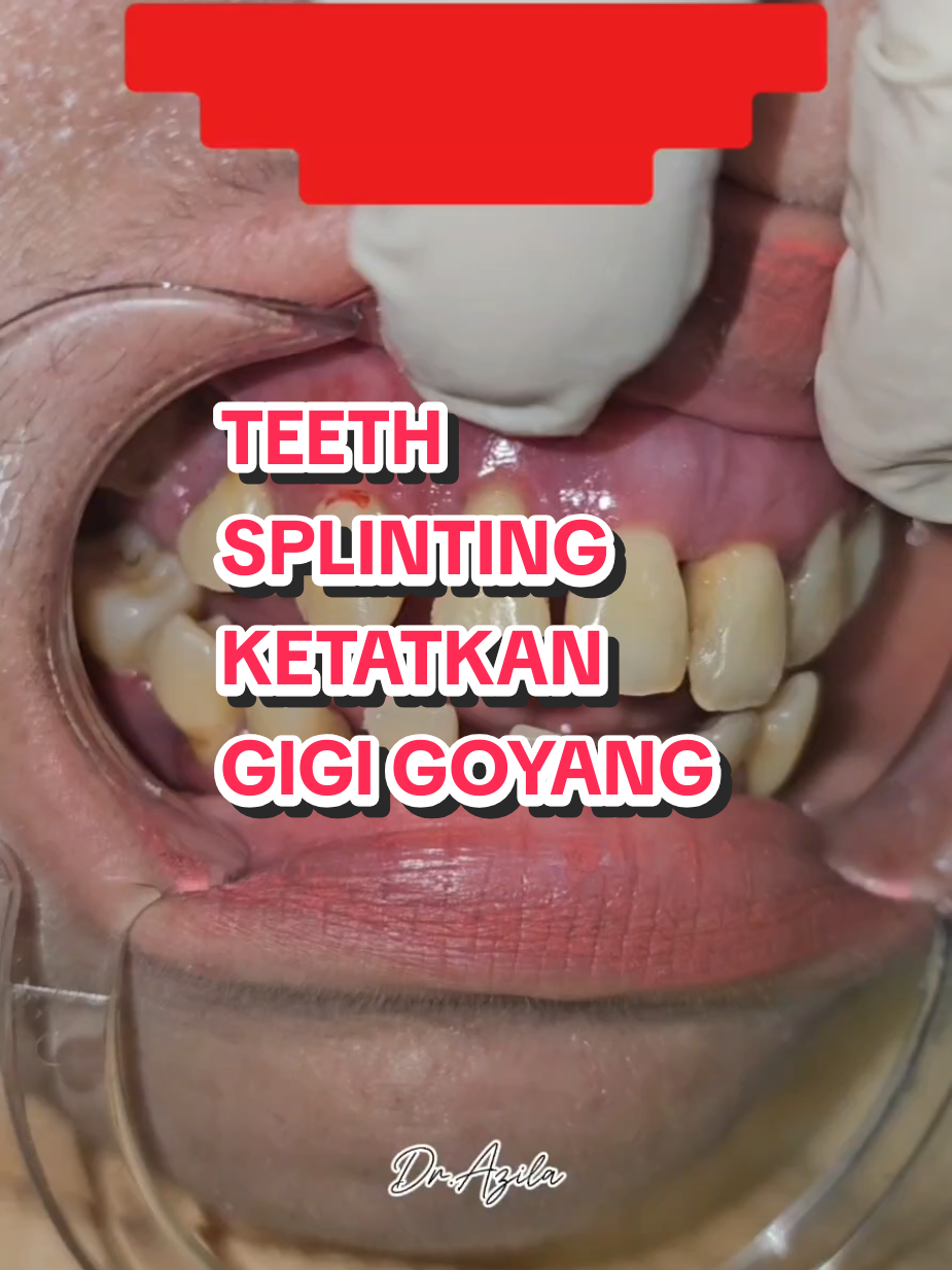 @Dr. Azila