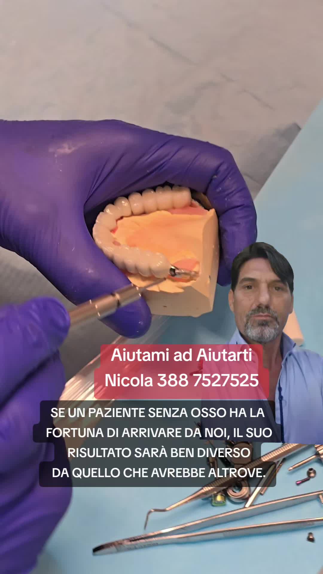 @Implantologiaprezzi