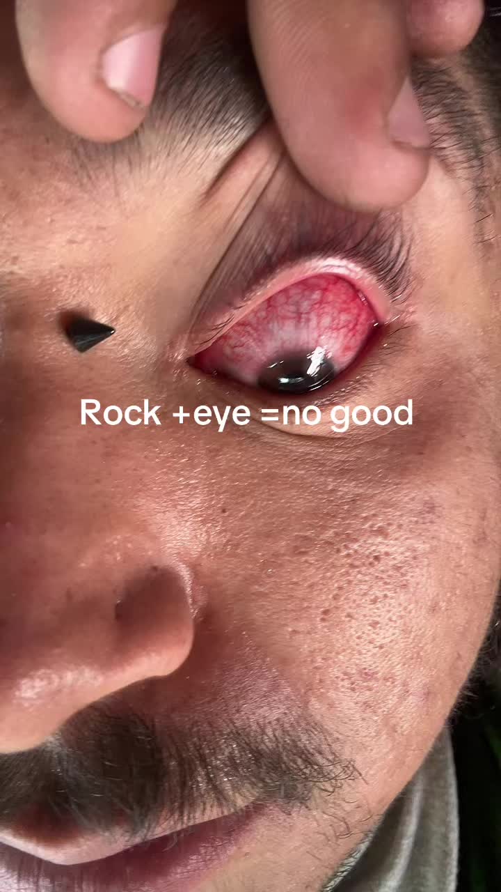 @DEAD