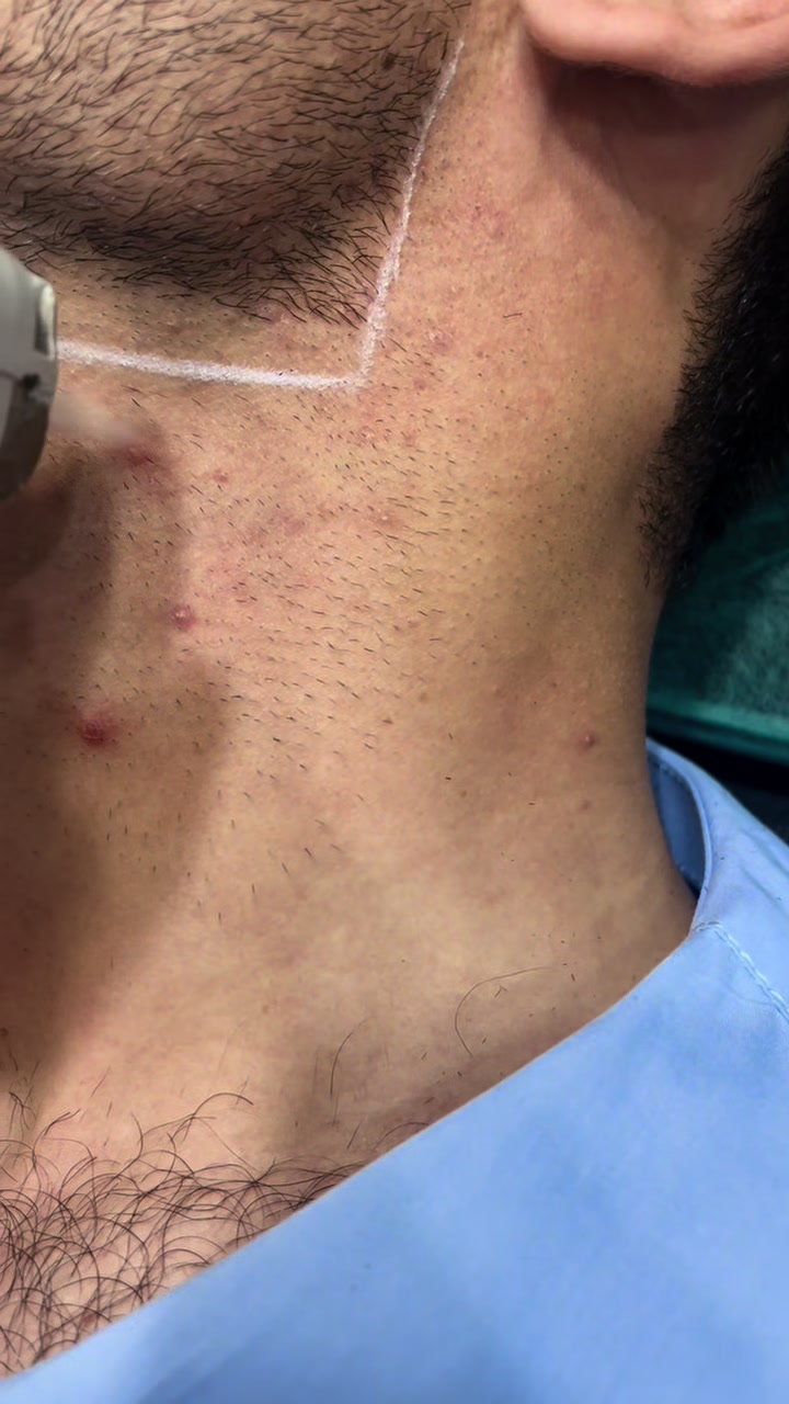 @Laser Grafix clinic