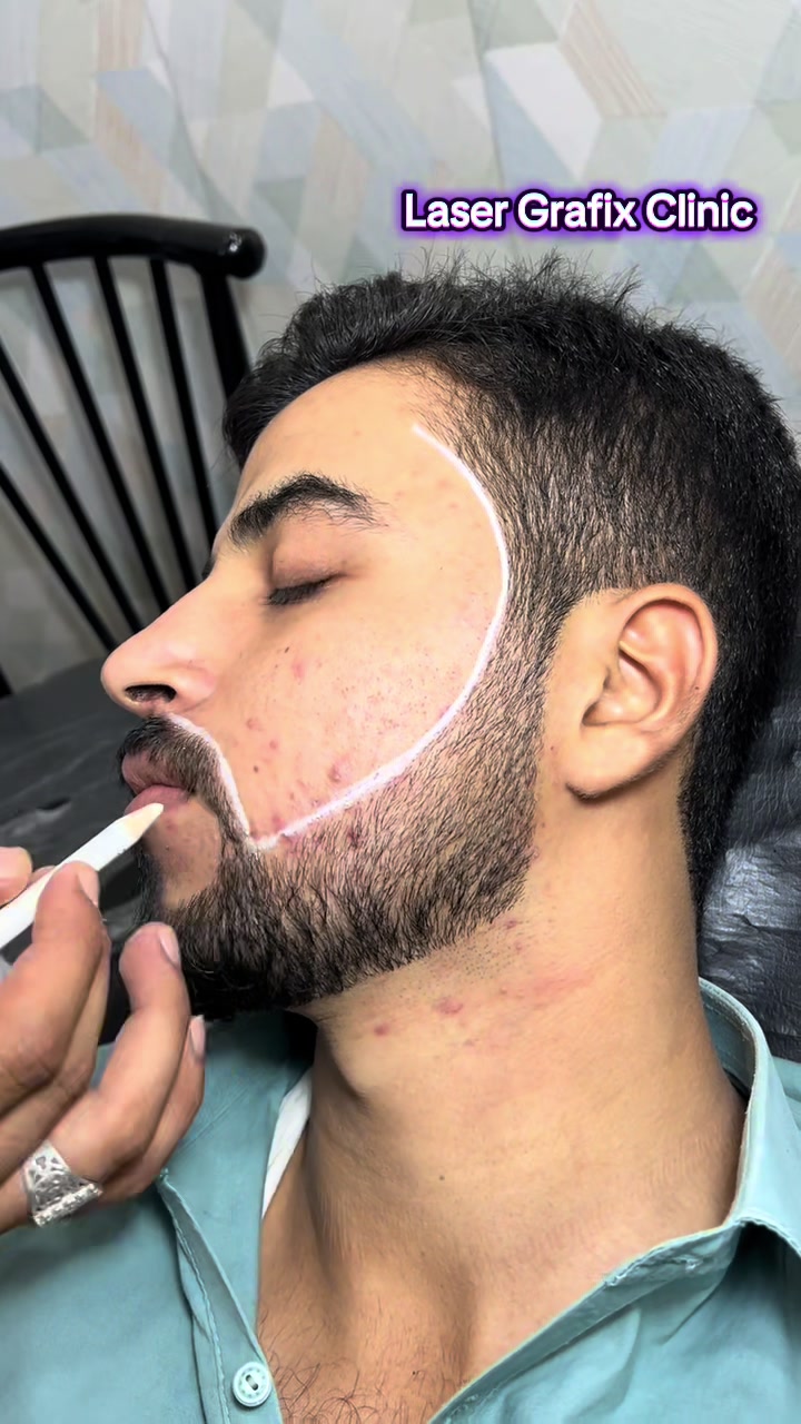@Laser Grafix clinic