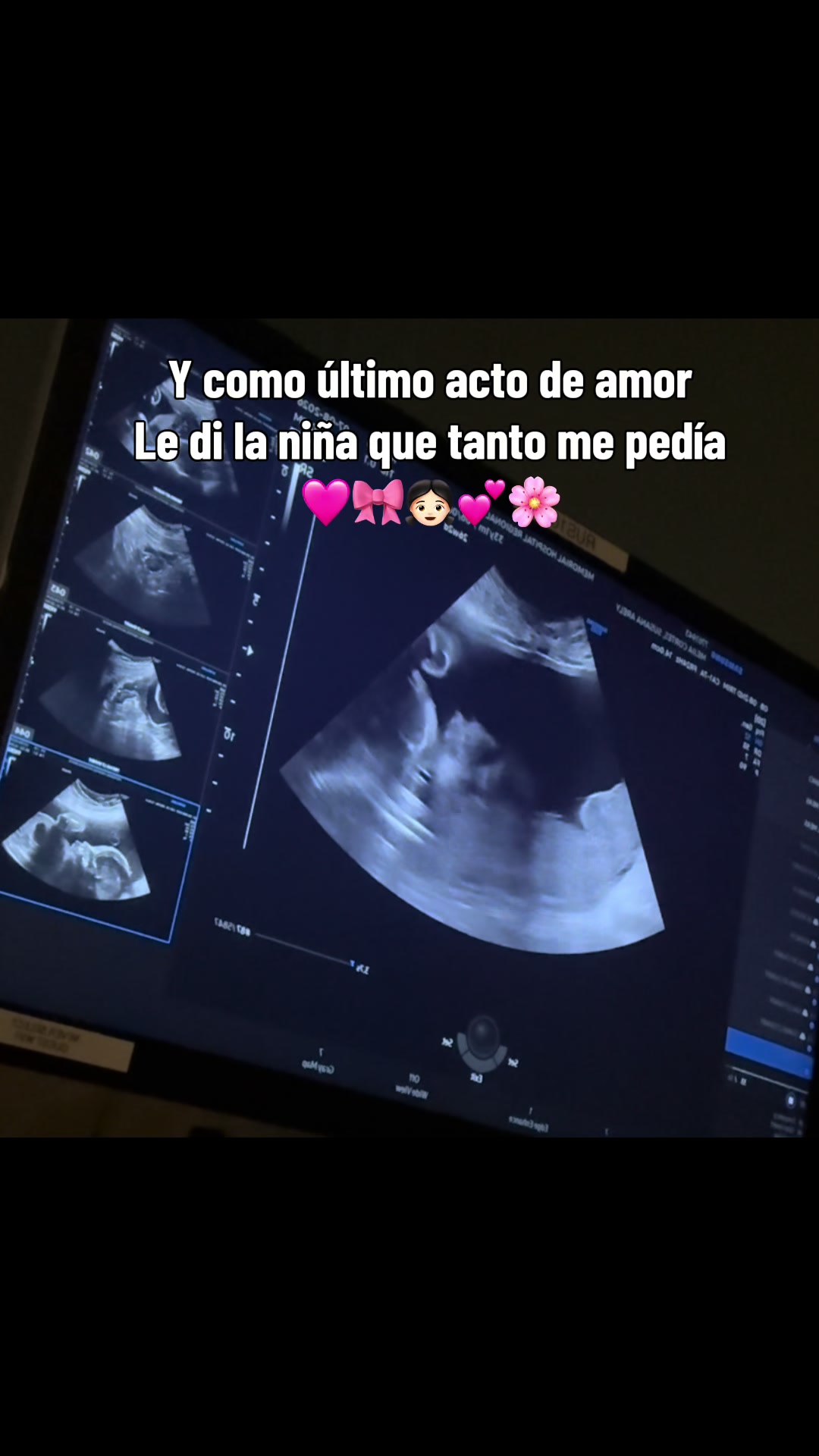 @Arely Mejia