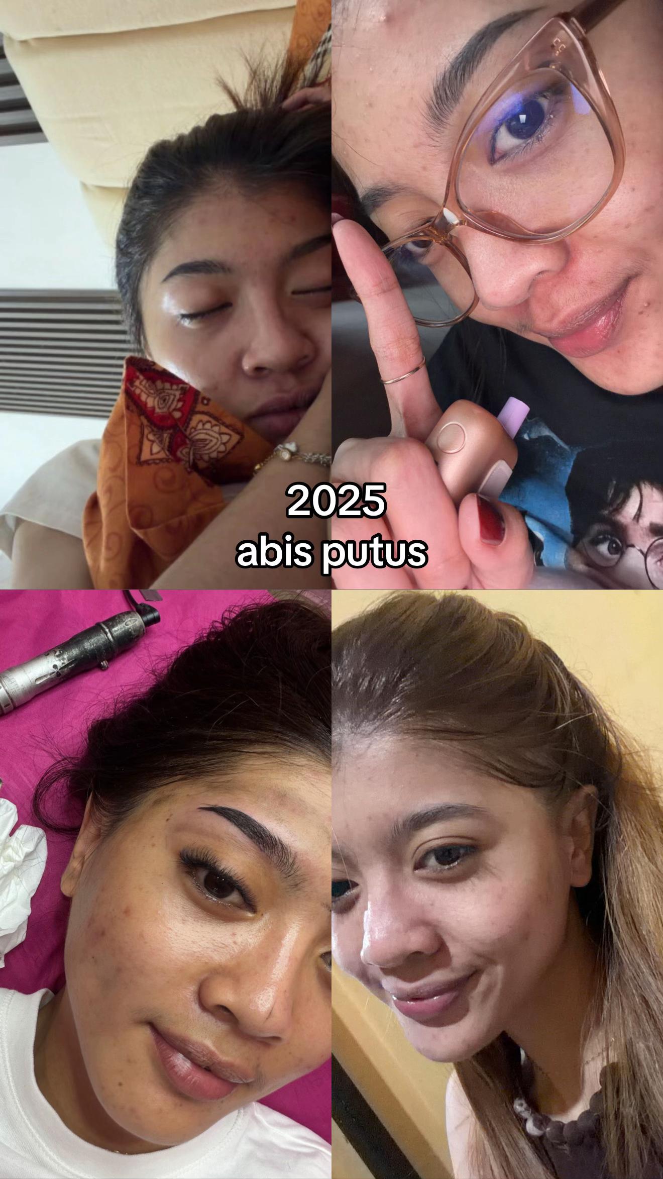 @putri