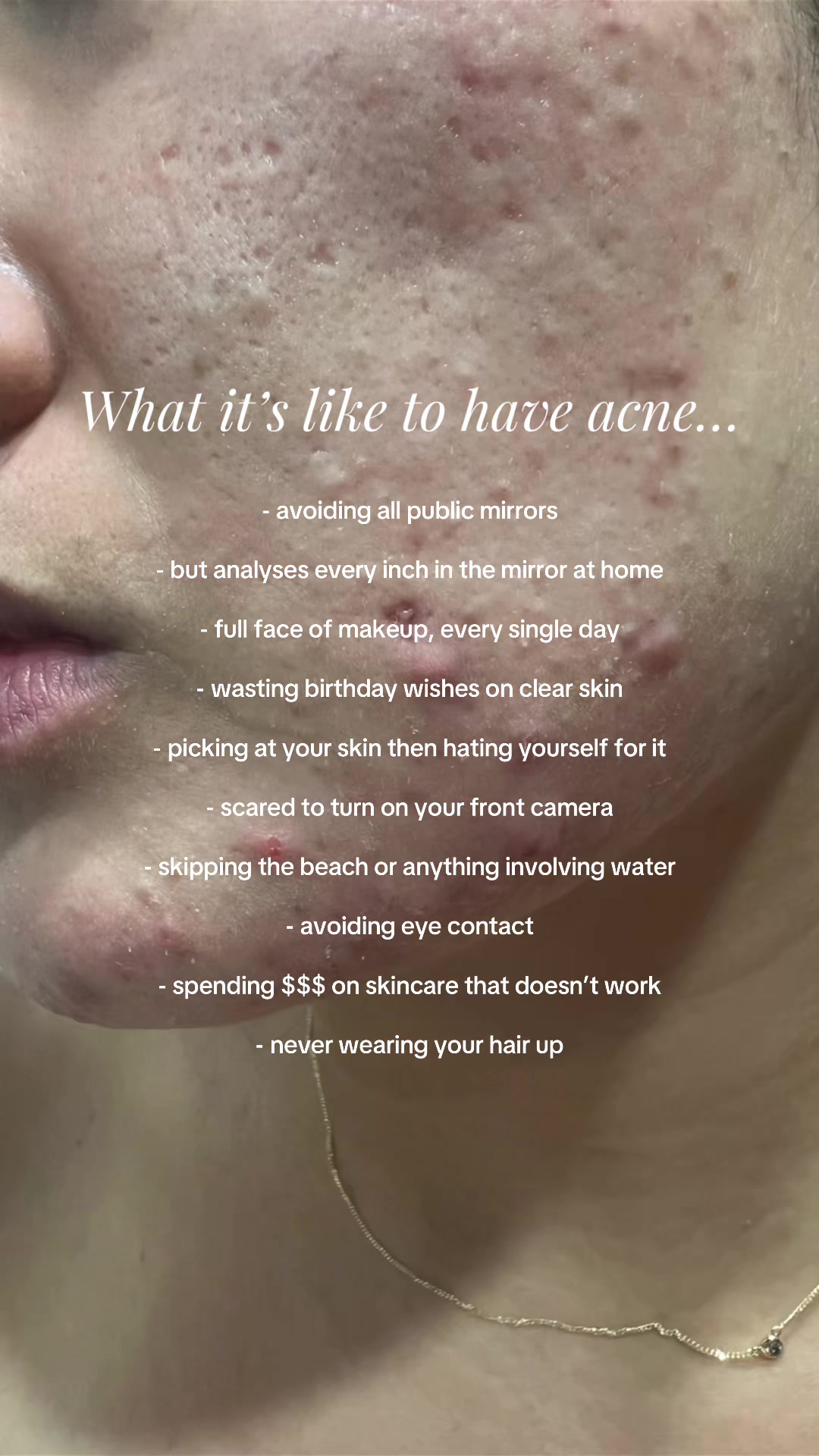 @Lisa | acne → clear skin