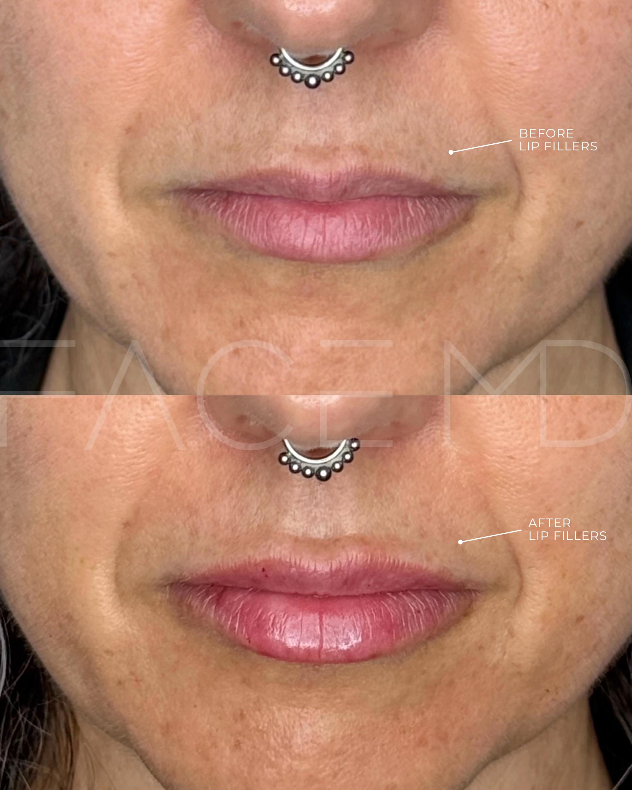 @cliniquefacemd