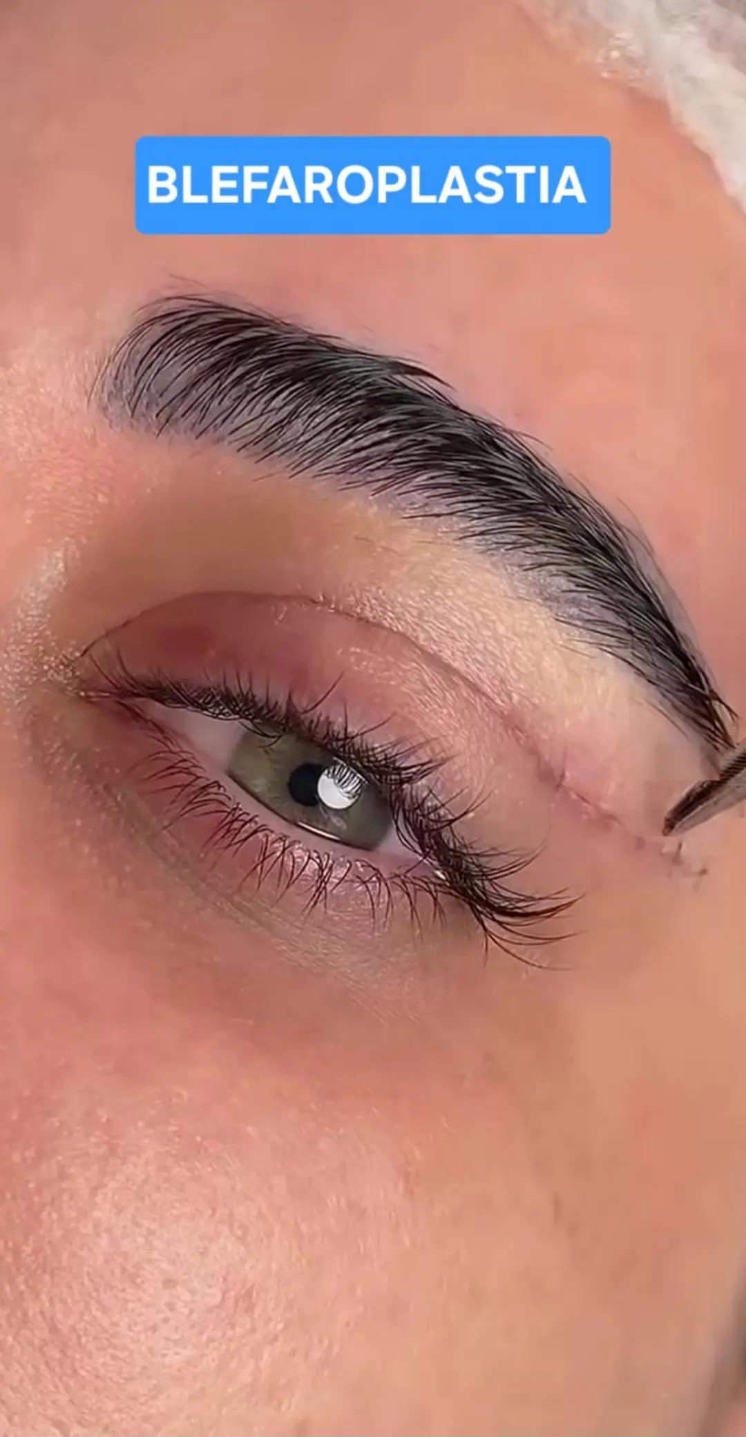 @Belanovacirugiaplastica
