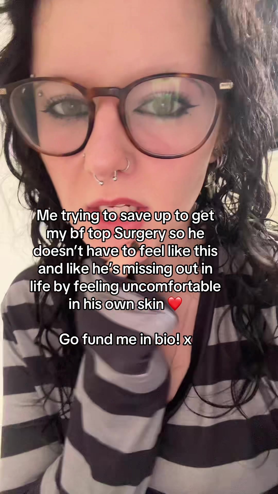@Mission top surgery for my bf
