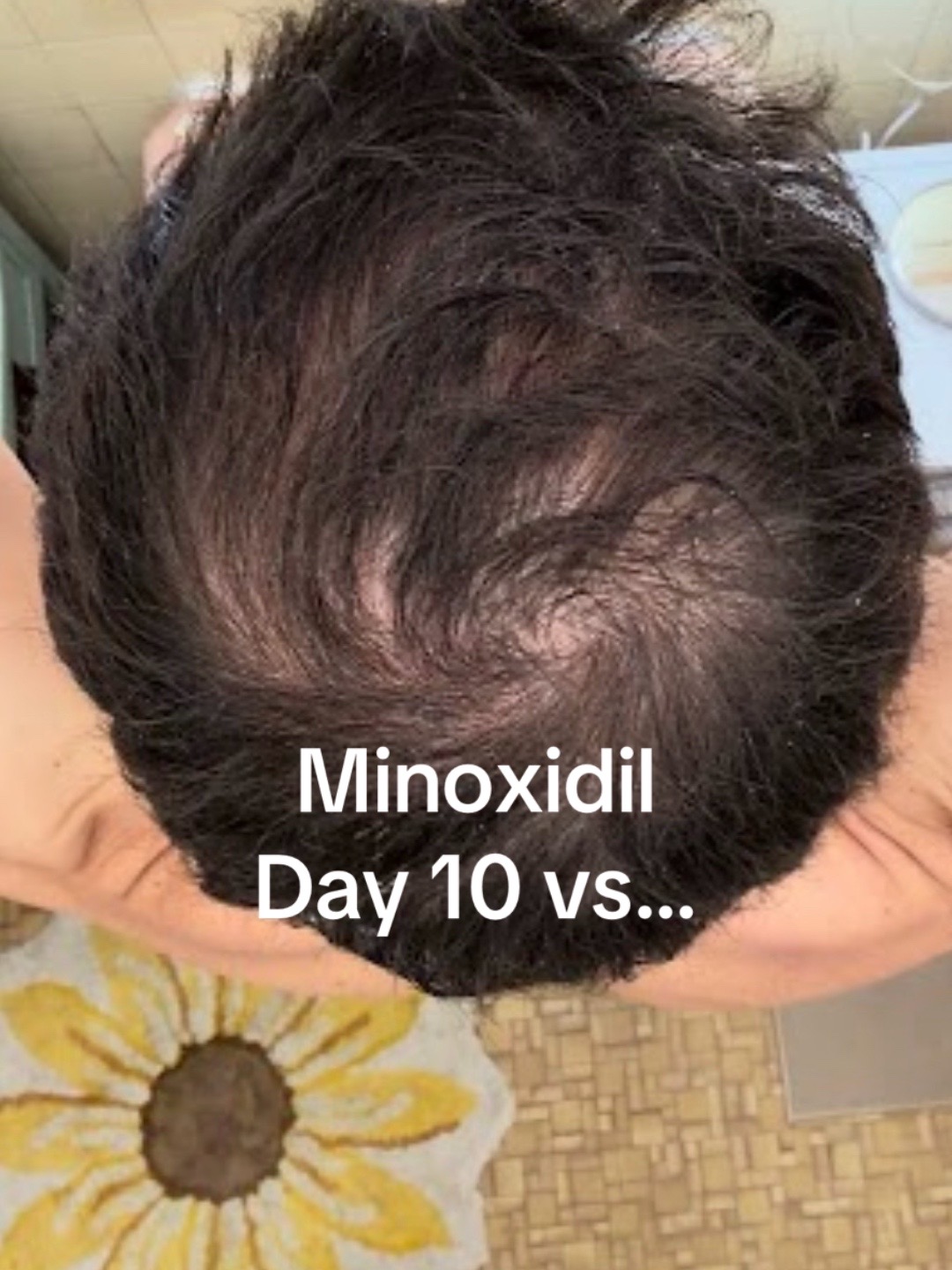 @scalp.hero