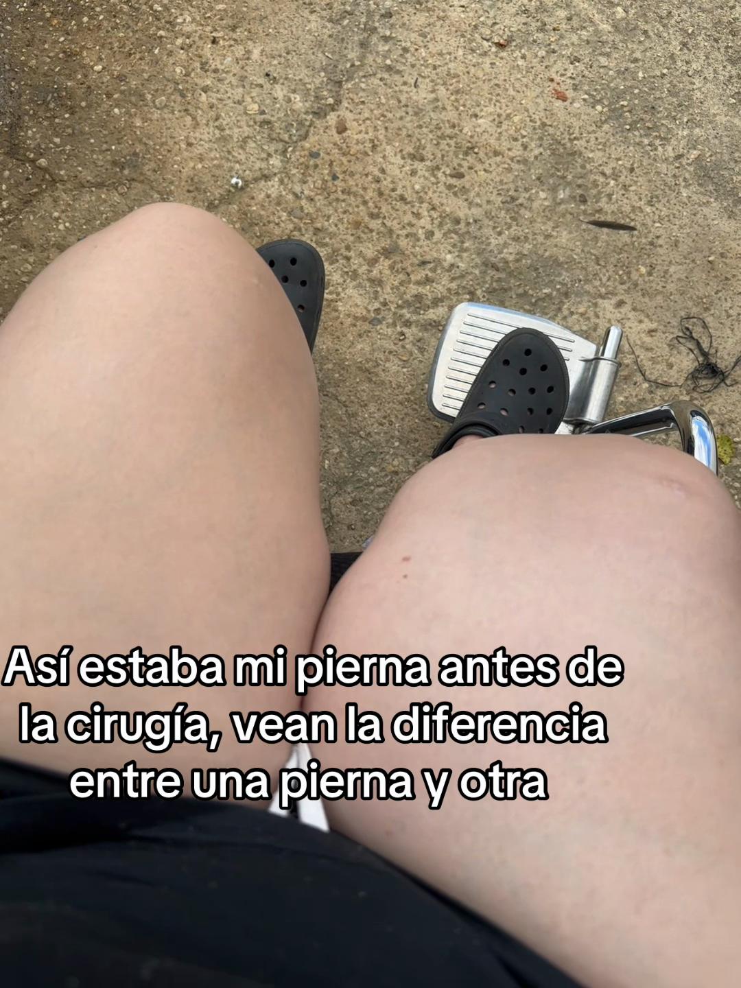 @Yole/ 🩼🦿🧑🦽