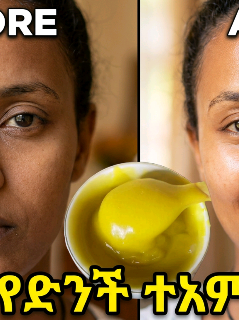 @የገጠር ልጅ✨🦋