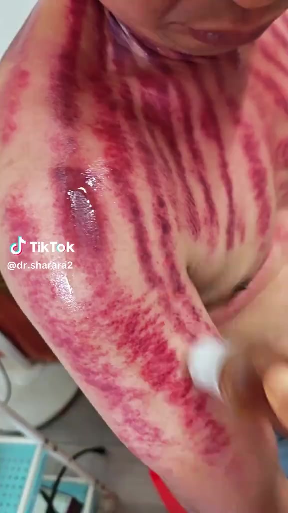 @th&iacute;ch cạo gi&oacute;