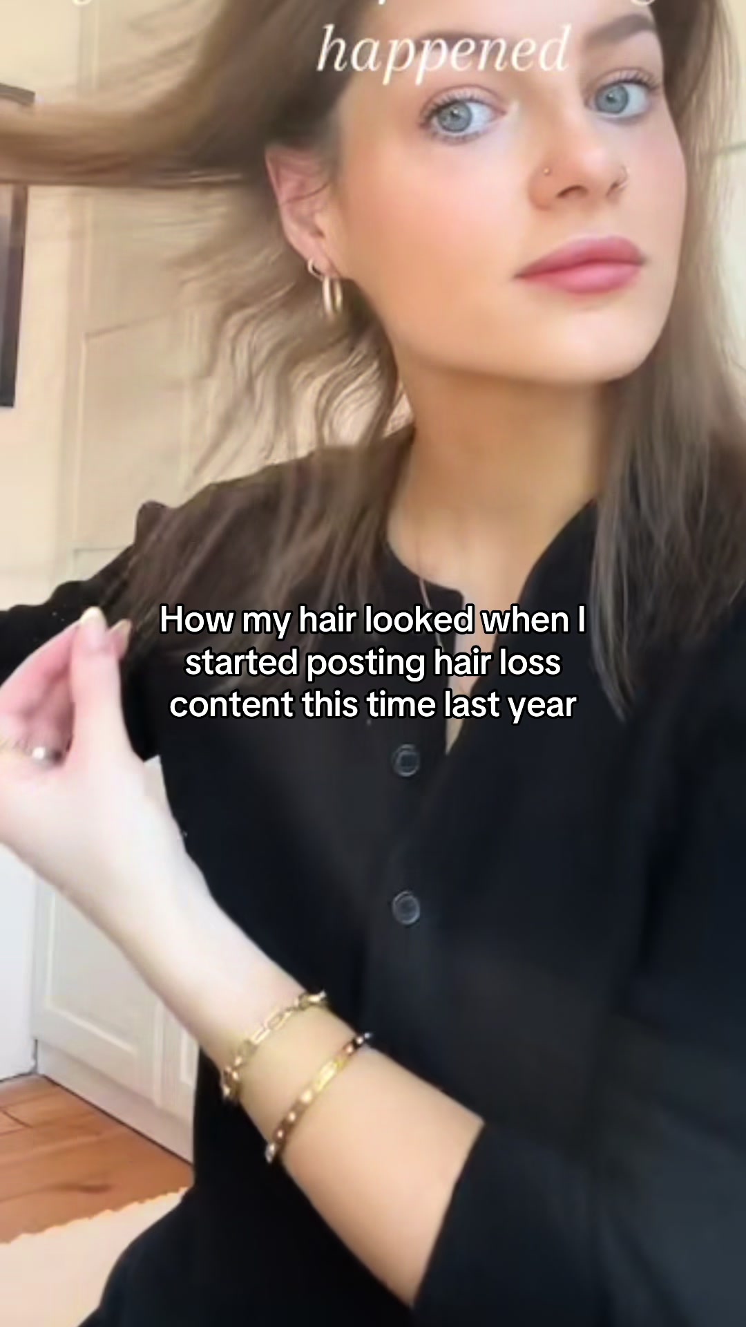 @Hairlossdiva