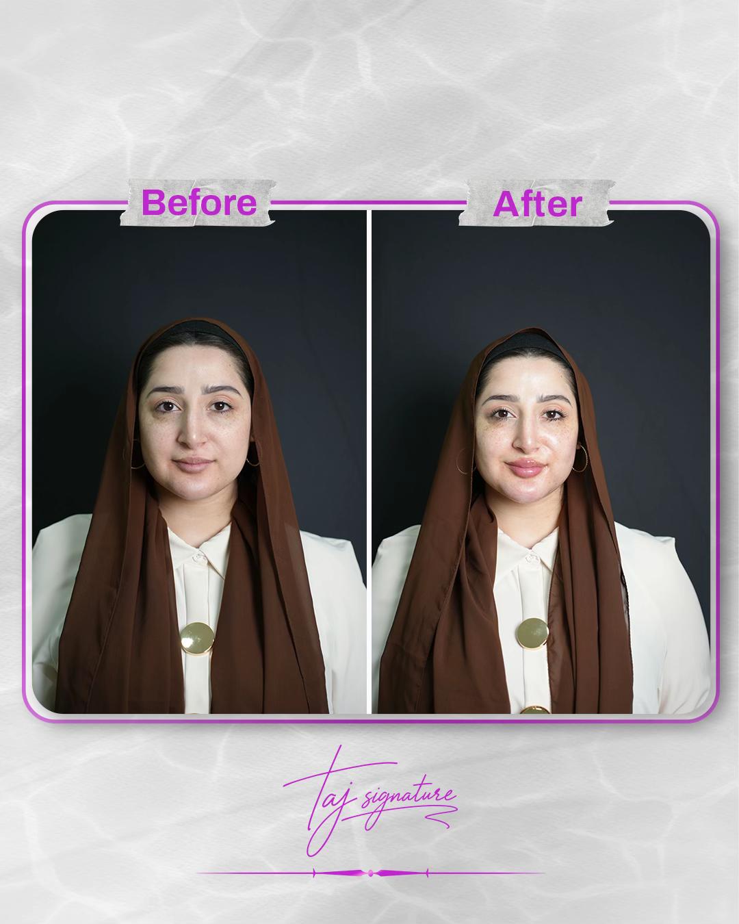 @Dr Taj Hammad