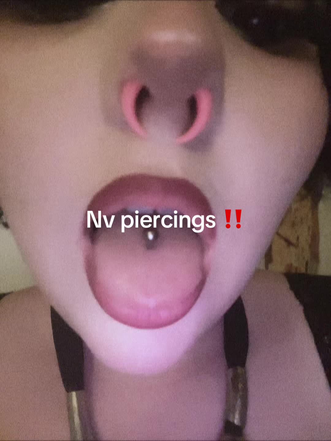 @🐝