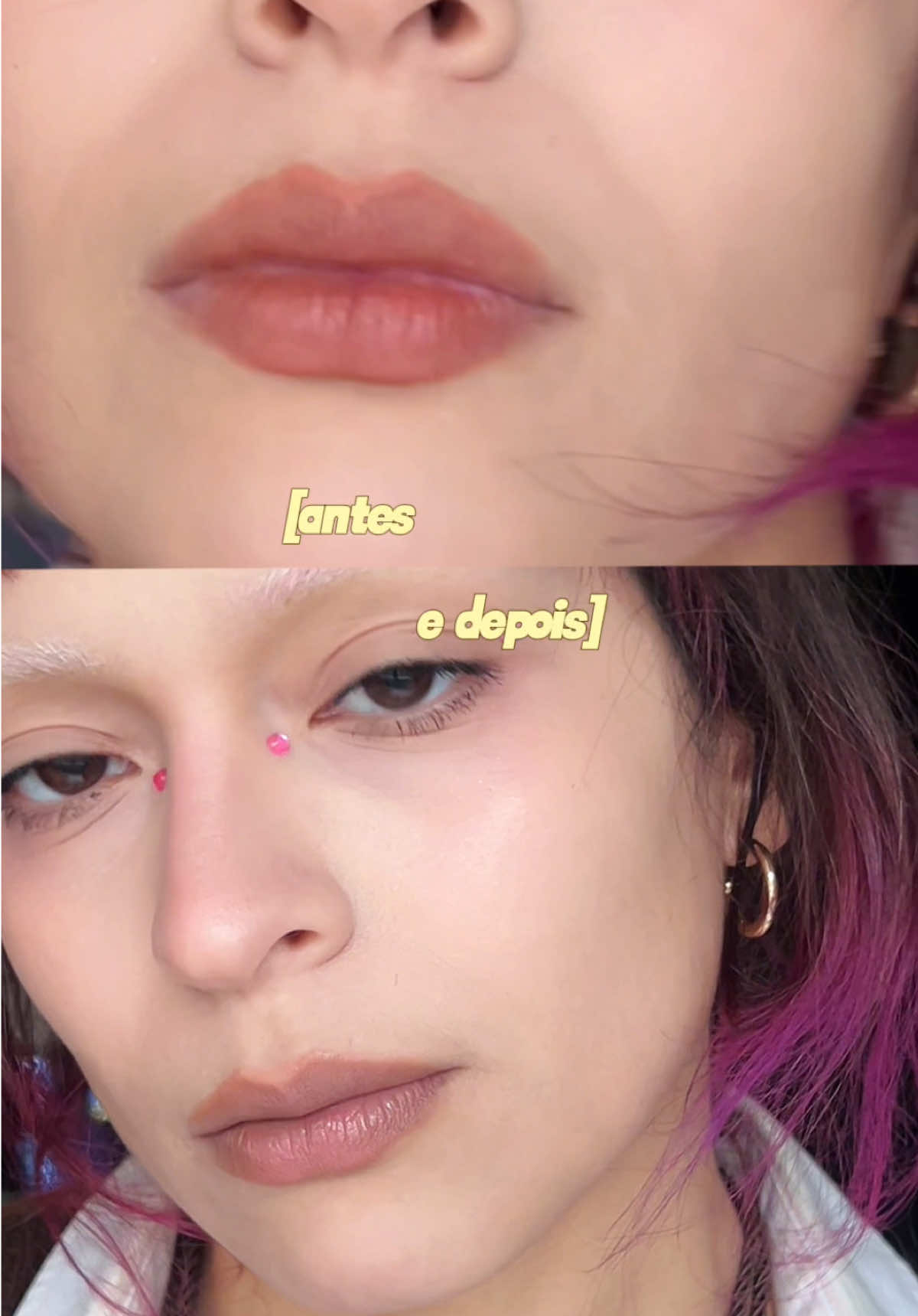 @anap <3