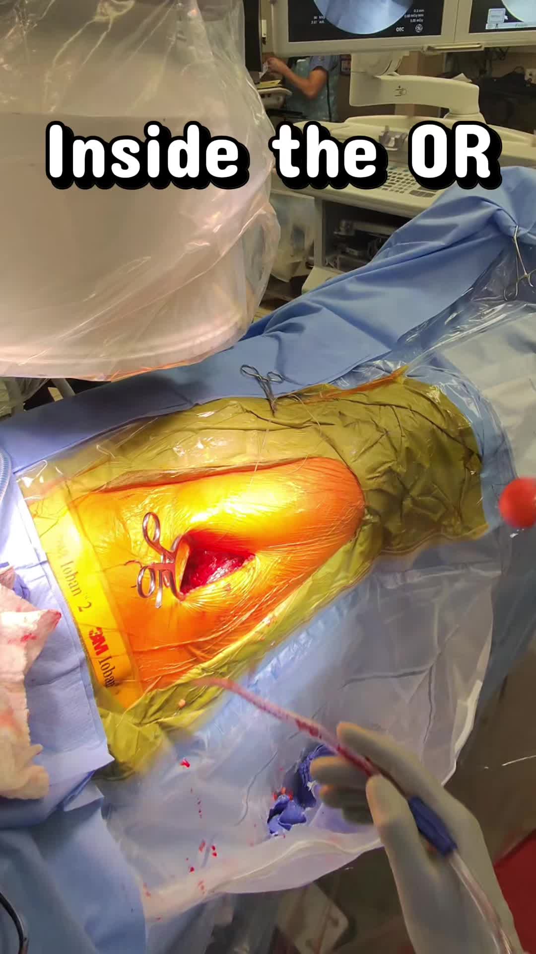 @Ortho POV