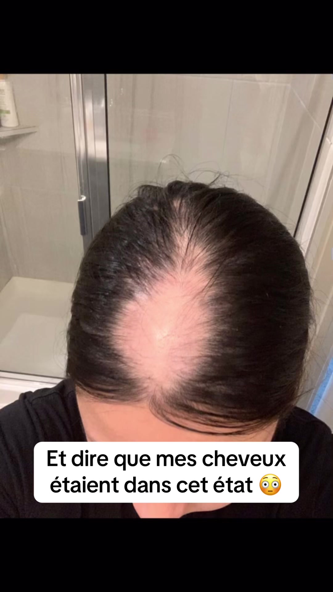 @Lux&rsquo;Hair Growth
