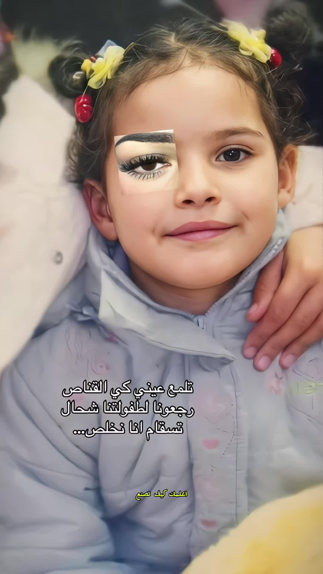 @Anne