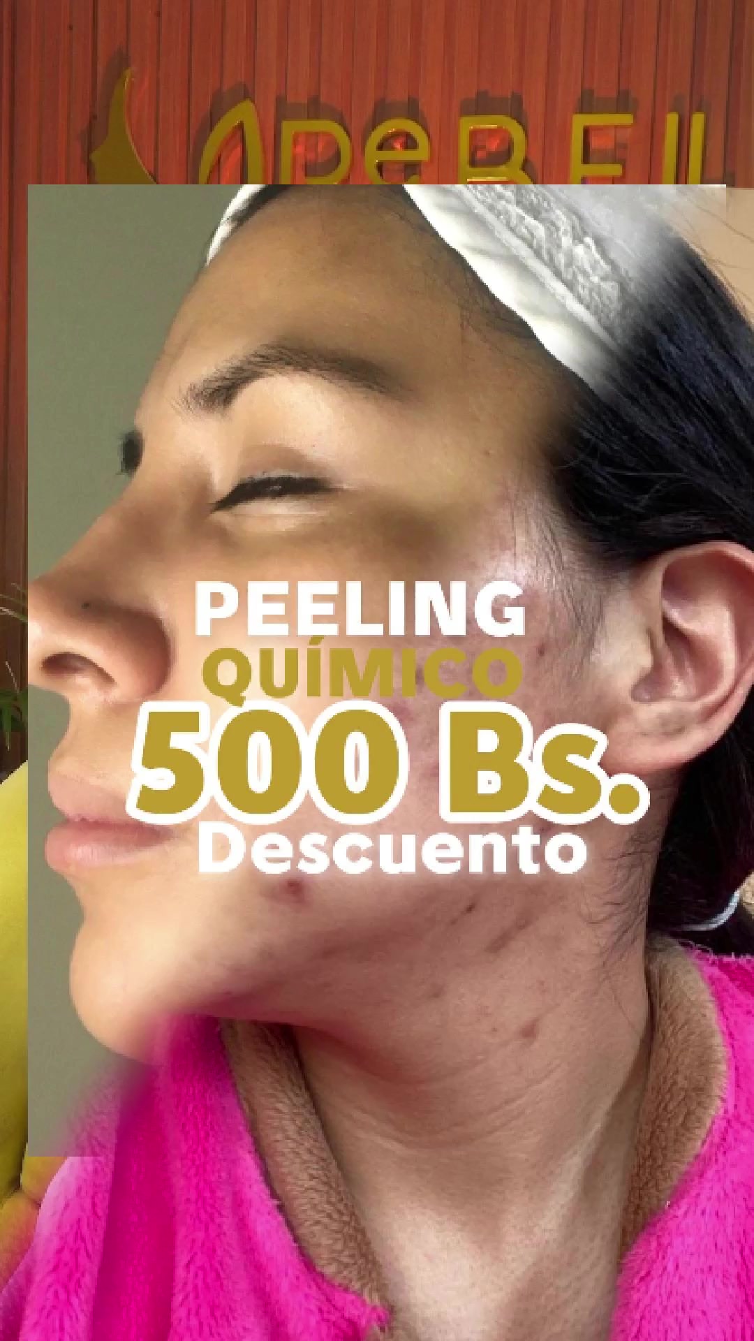 @RebellSpa