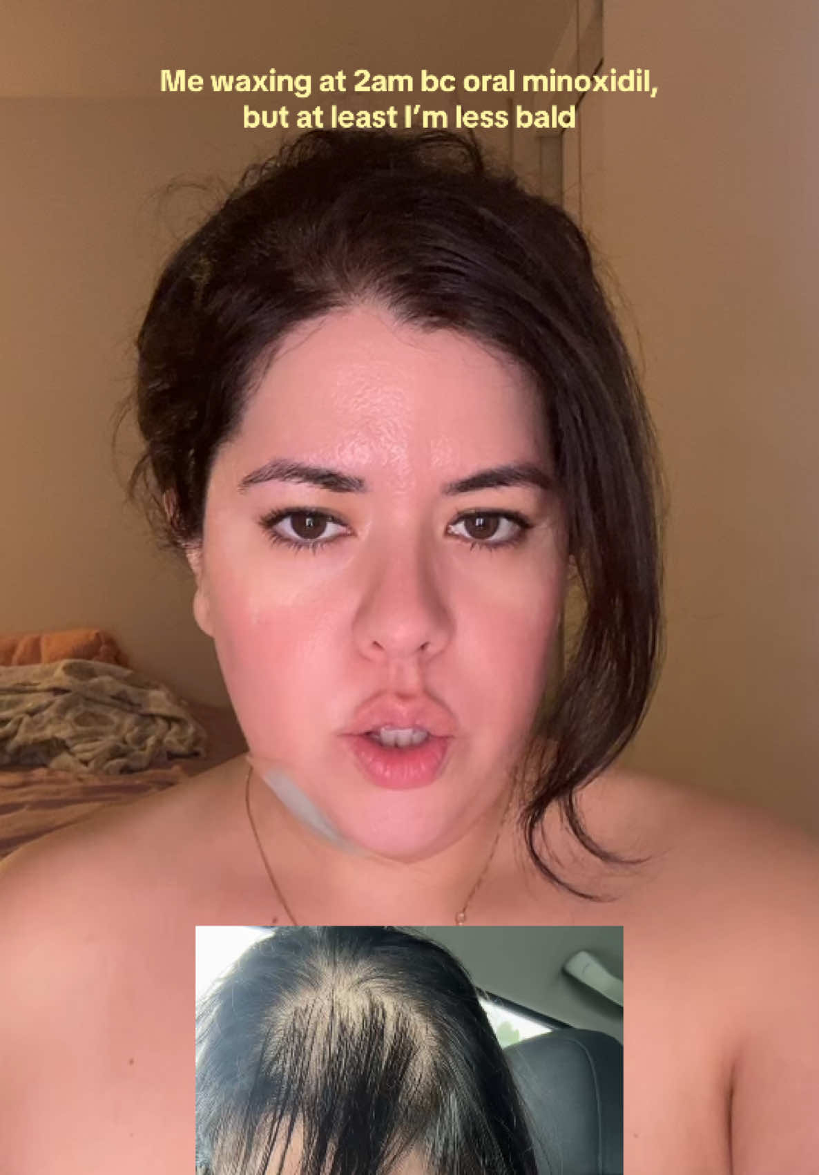 @Bianca