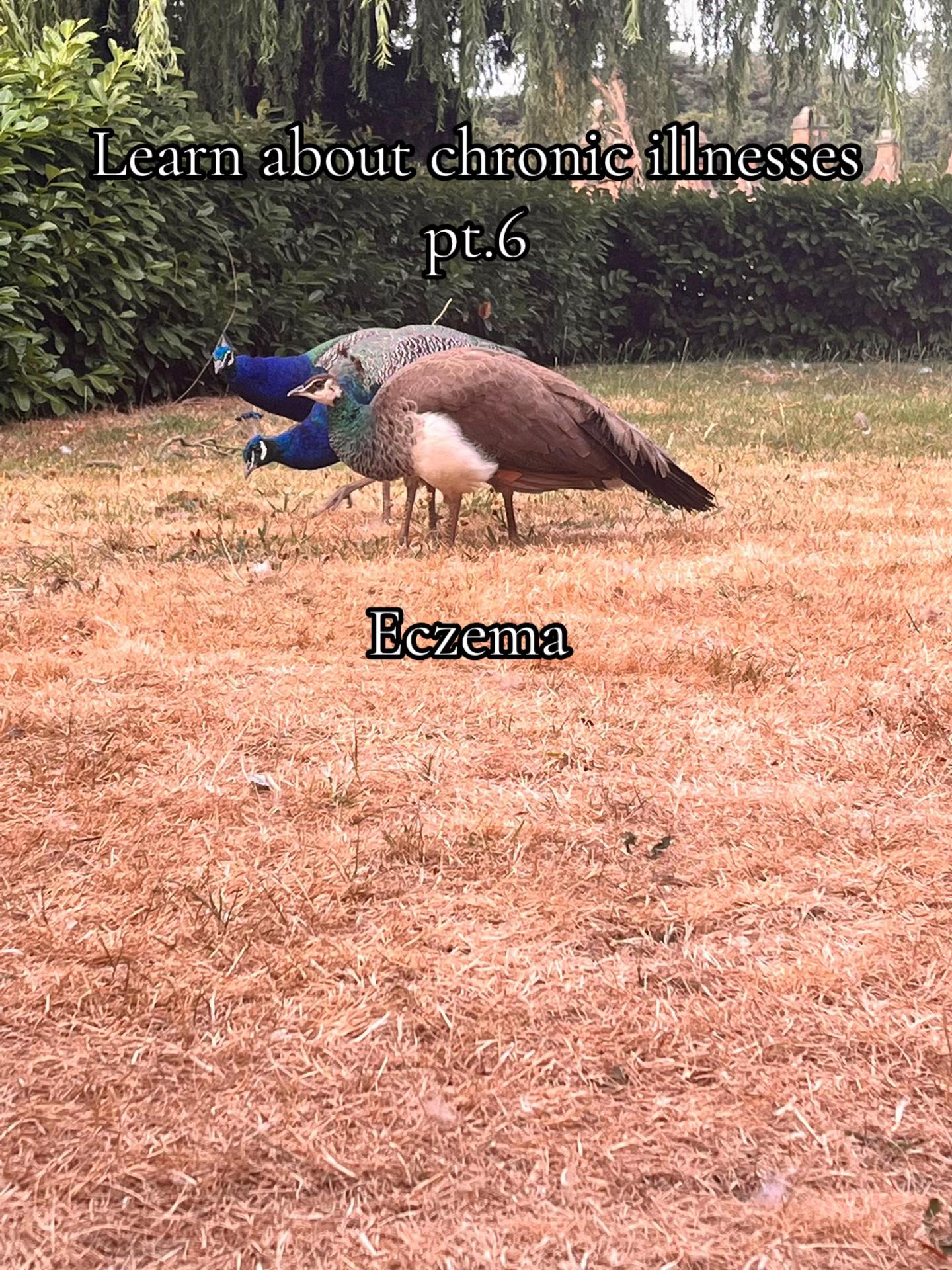 @𝓛𝓲𝓵𝔂 𝓪𝓷𝓷