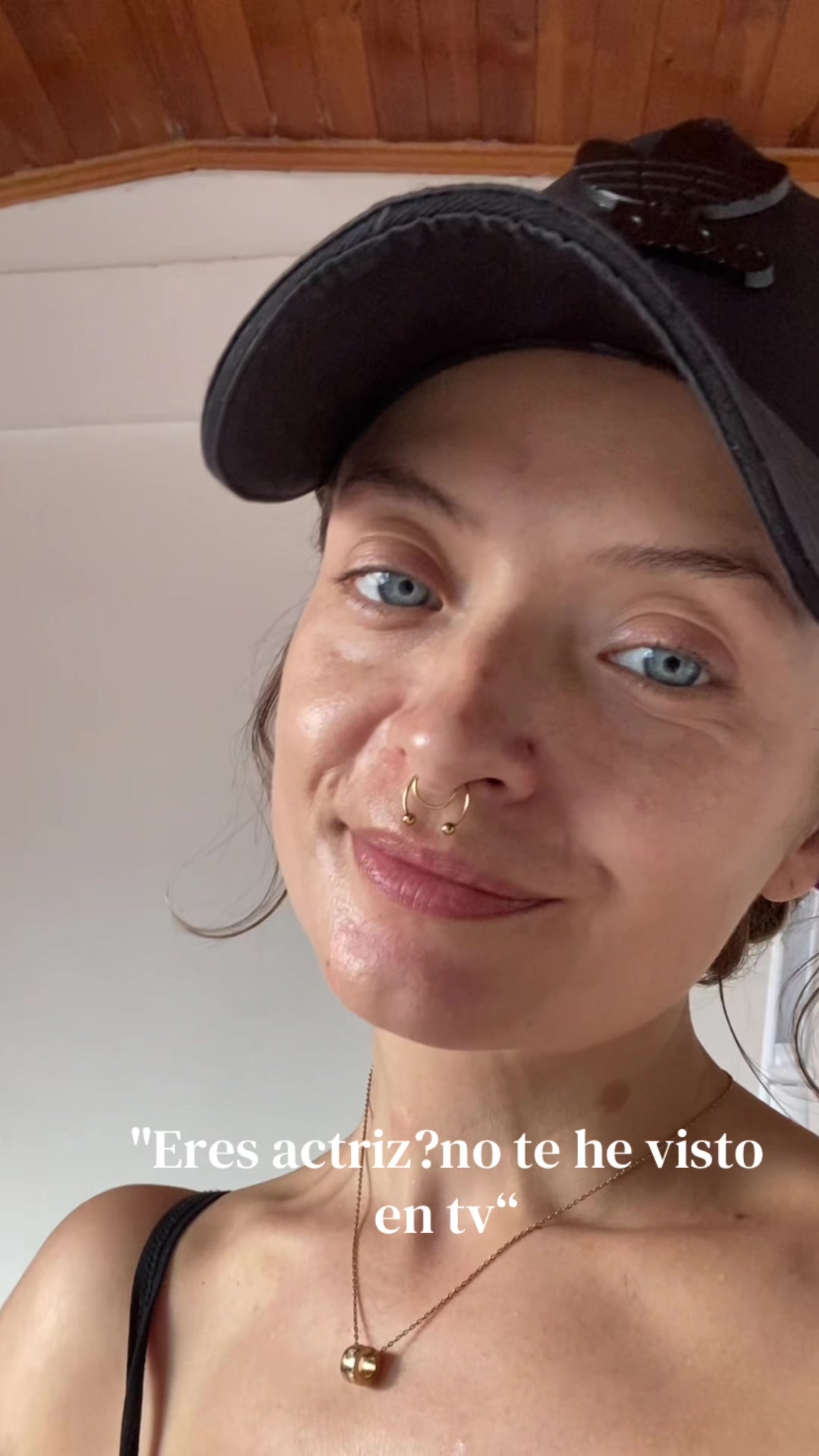 @cattalolo